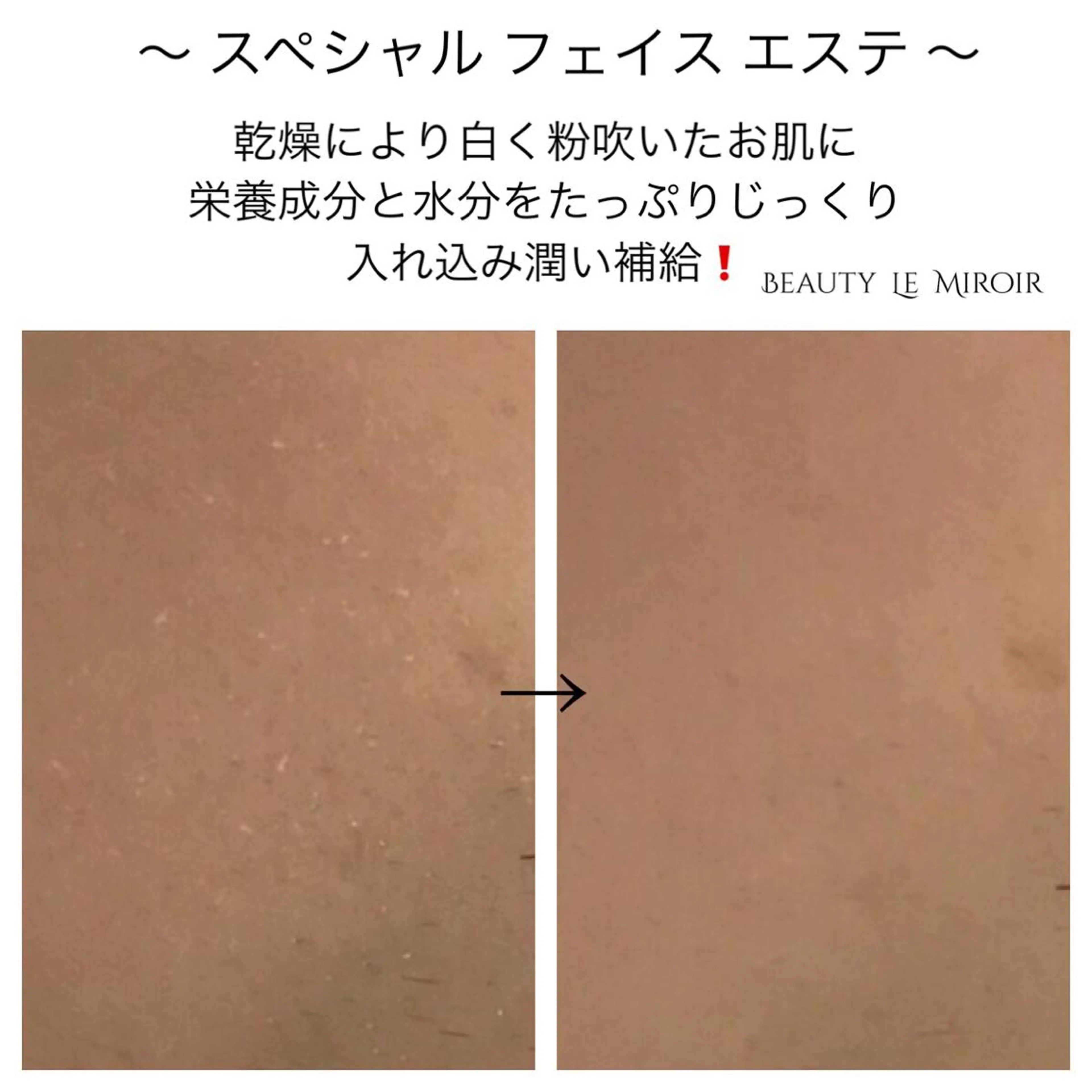 ビューティー ミロワールのエステ・リラクイメージ