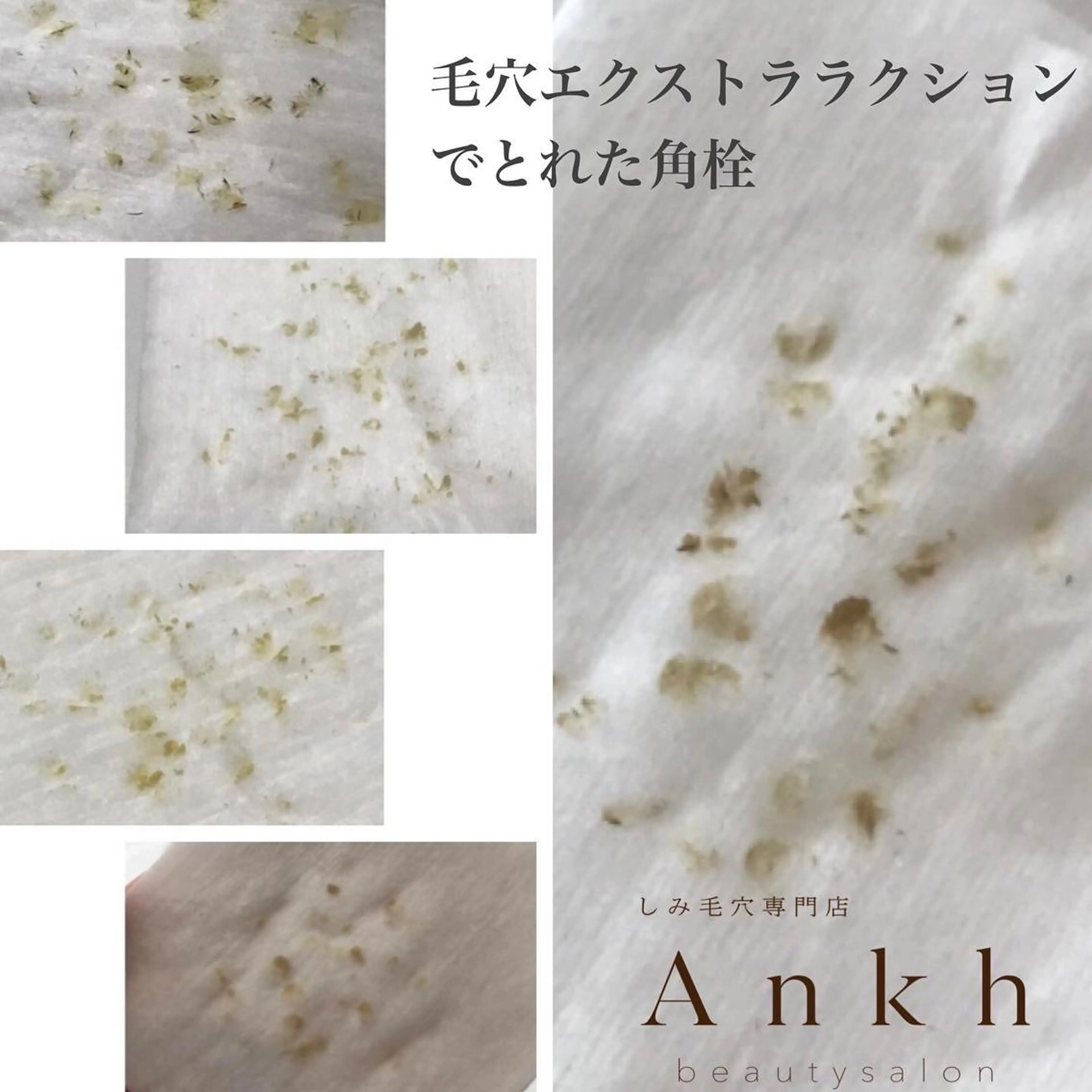 しみ毛穴専門店 Ankh 平田のエステ・リラクイメージ