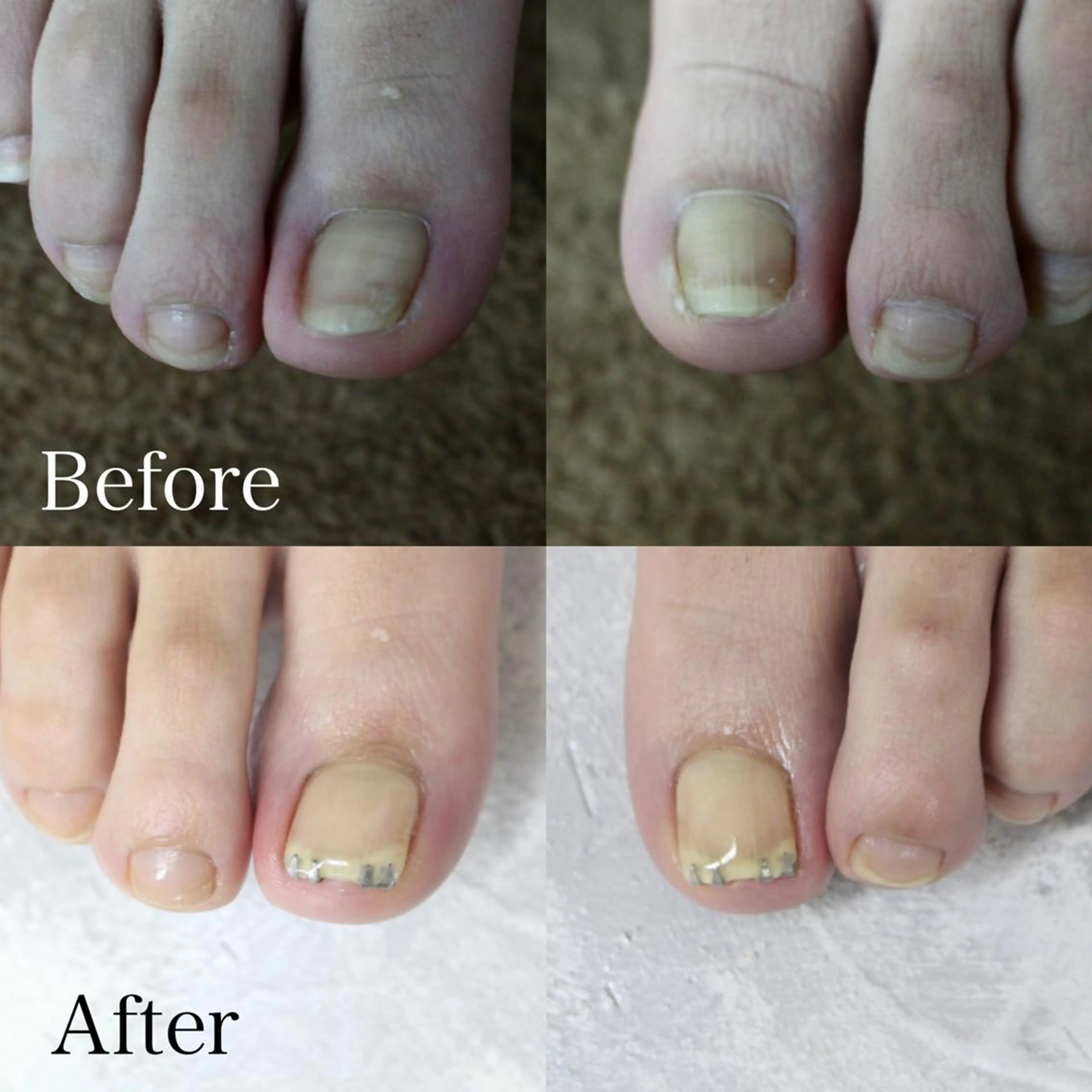 東 あきらのネイルデザイン