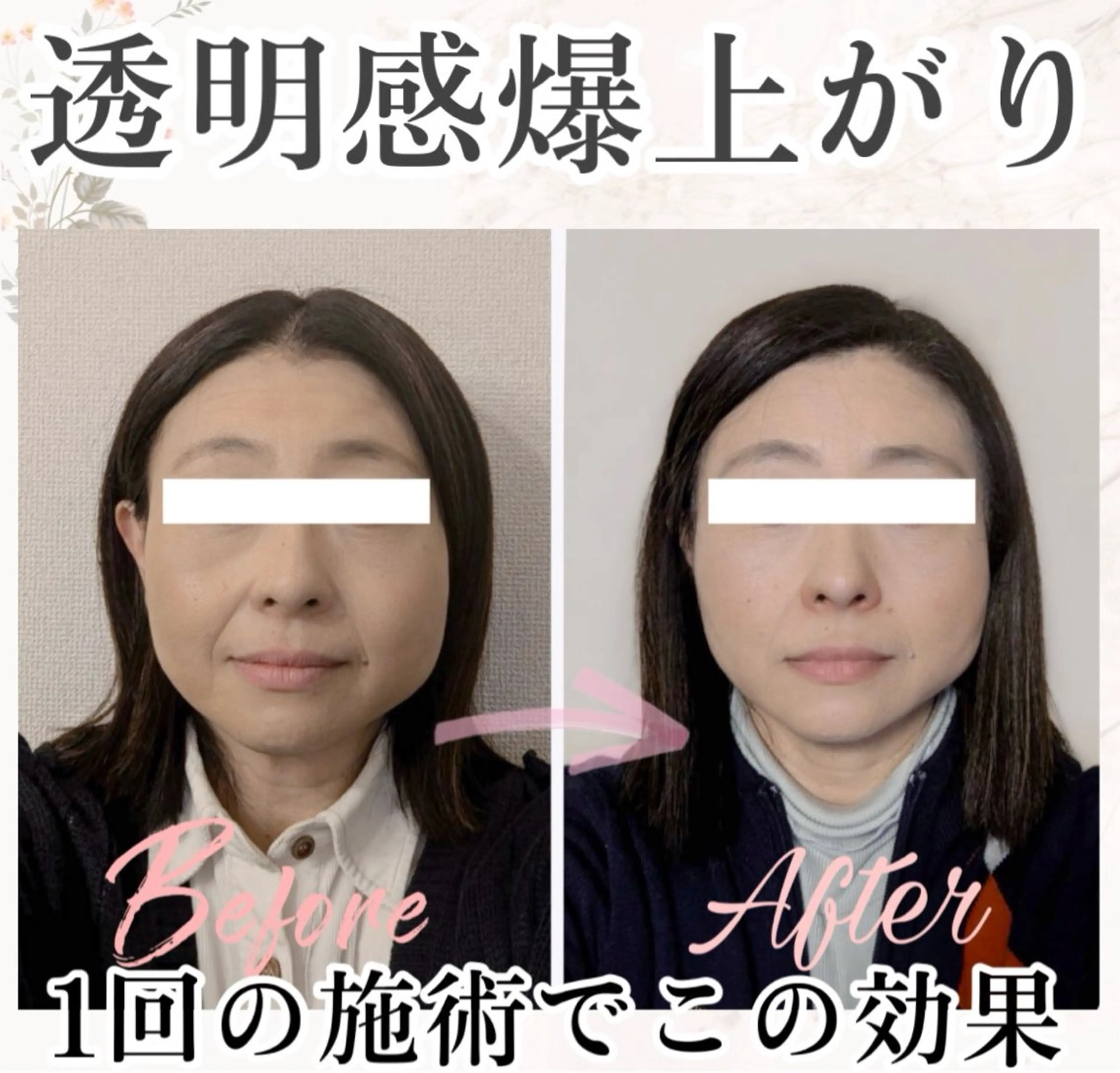 その他 小顔矯正専門 🪽アシュネ平野のエステ・リラクイメージ