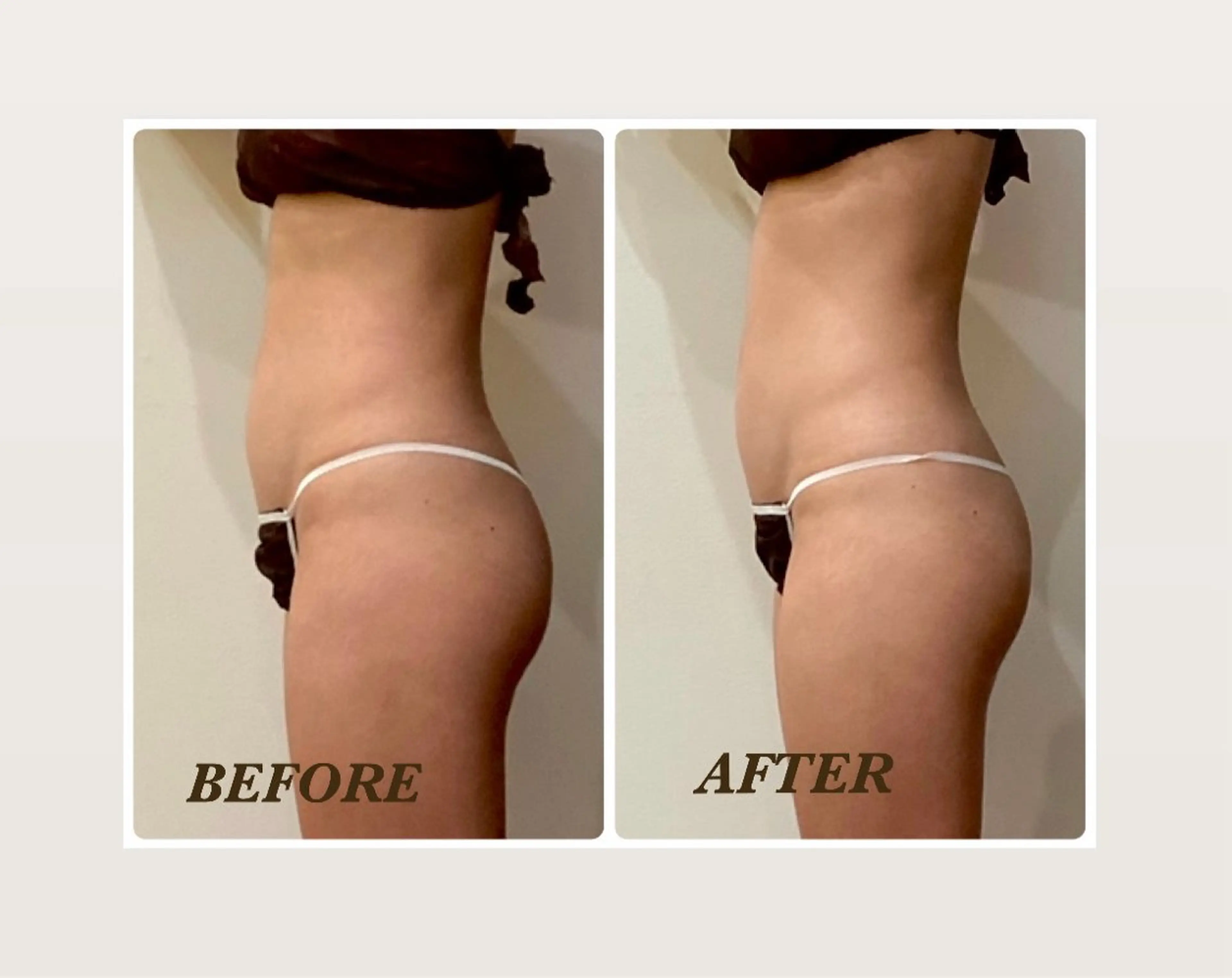 エステ リラク Prima 痩身脱毛 にごうかおりのエステ・リラクイメージ