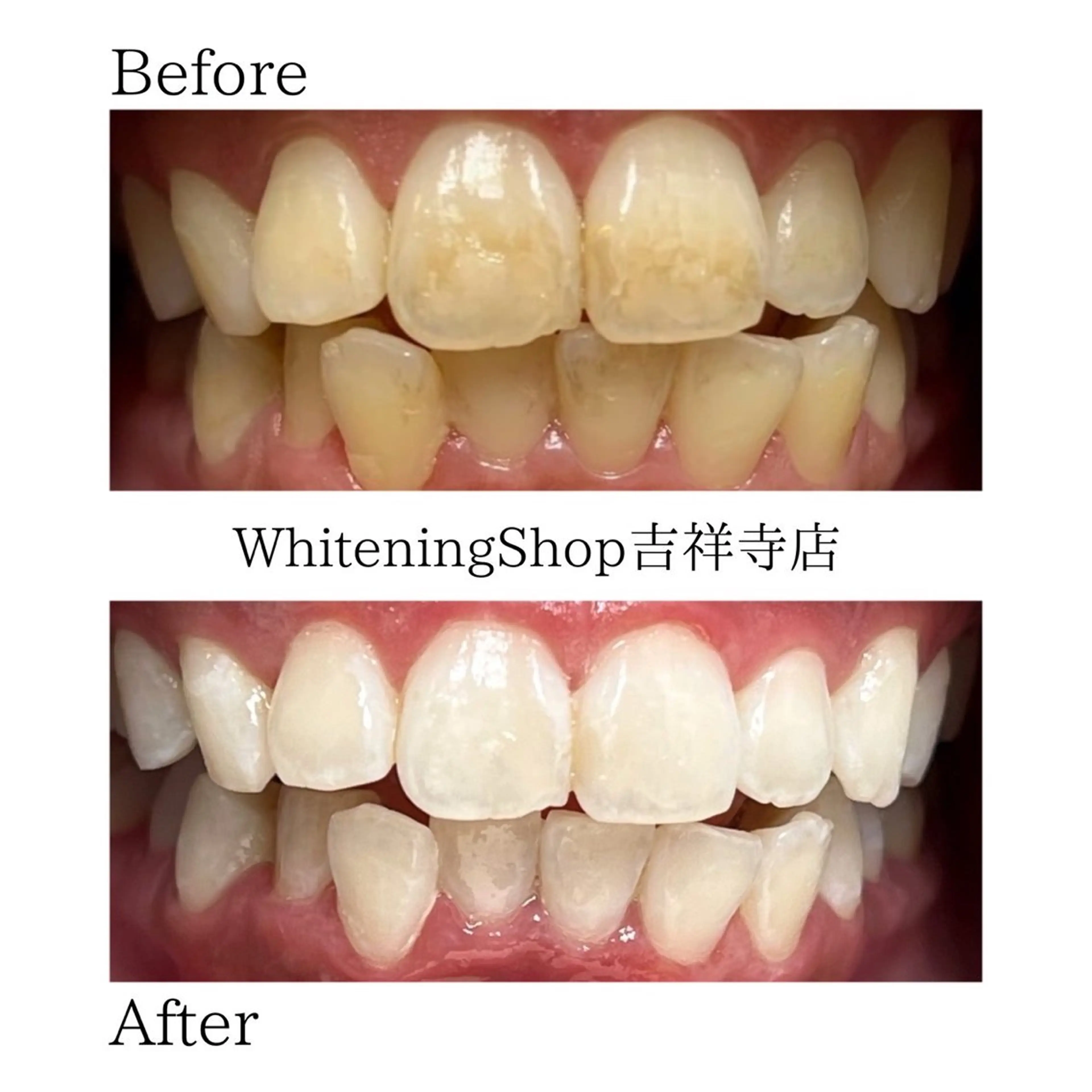 エステ リラク ホワイトニング ショップ吉祥寺店のエステ・リラクイメージ