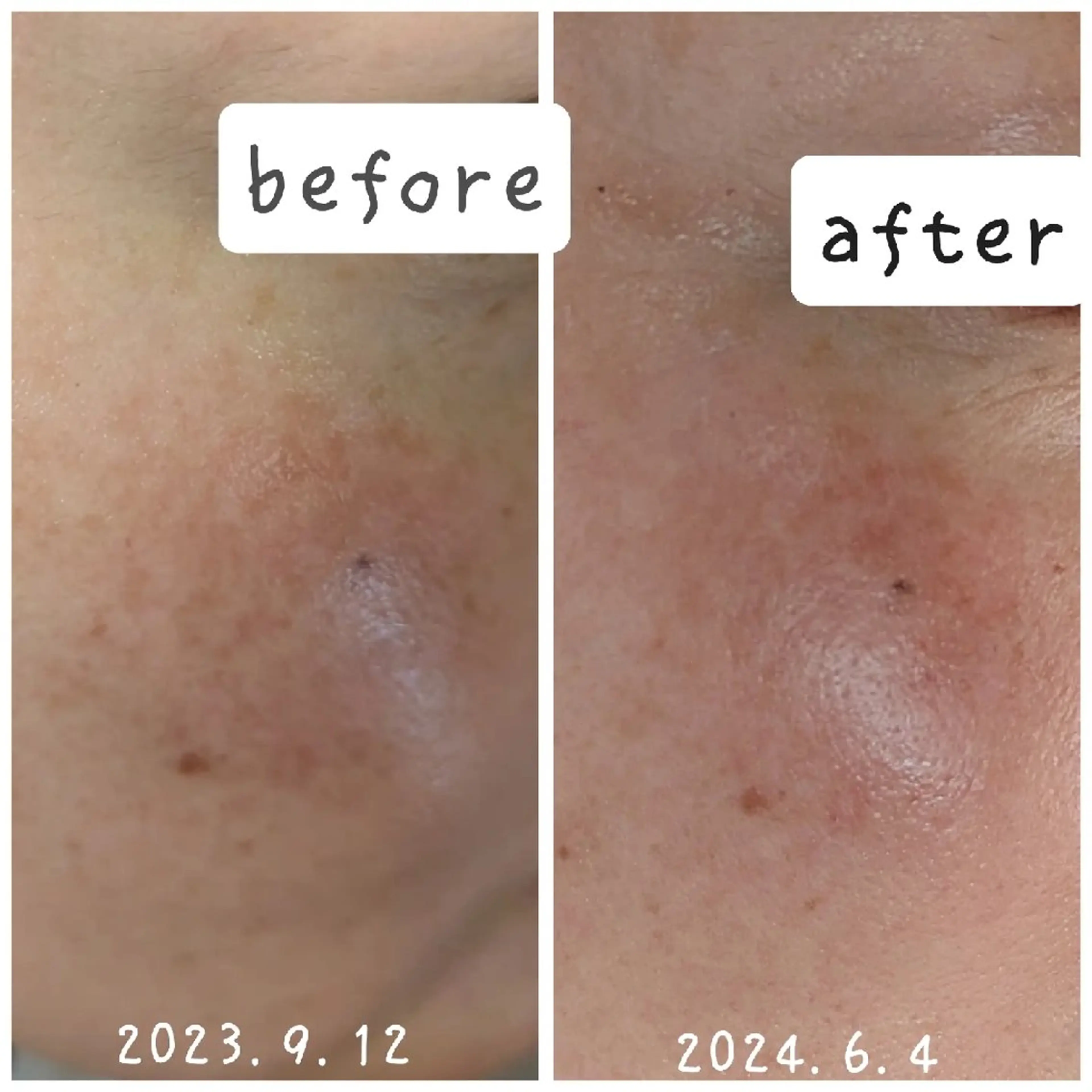 結果が出るスキンケア 肌質改善/まつパのエステ・リラクイメージ