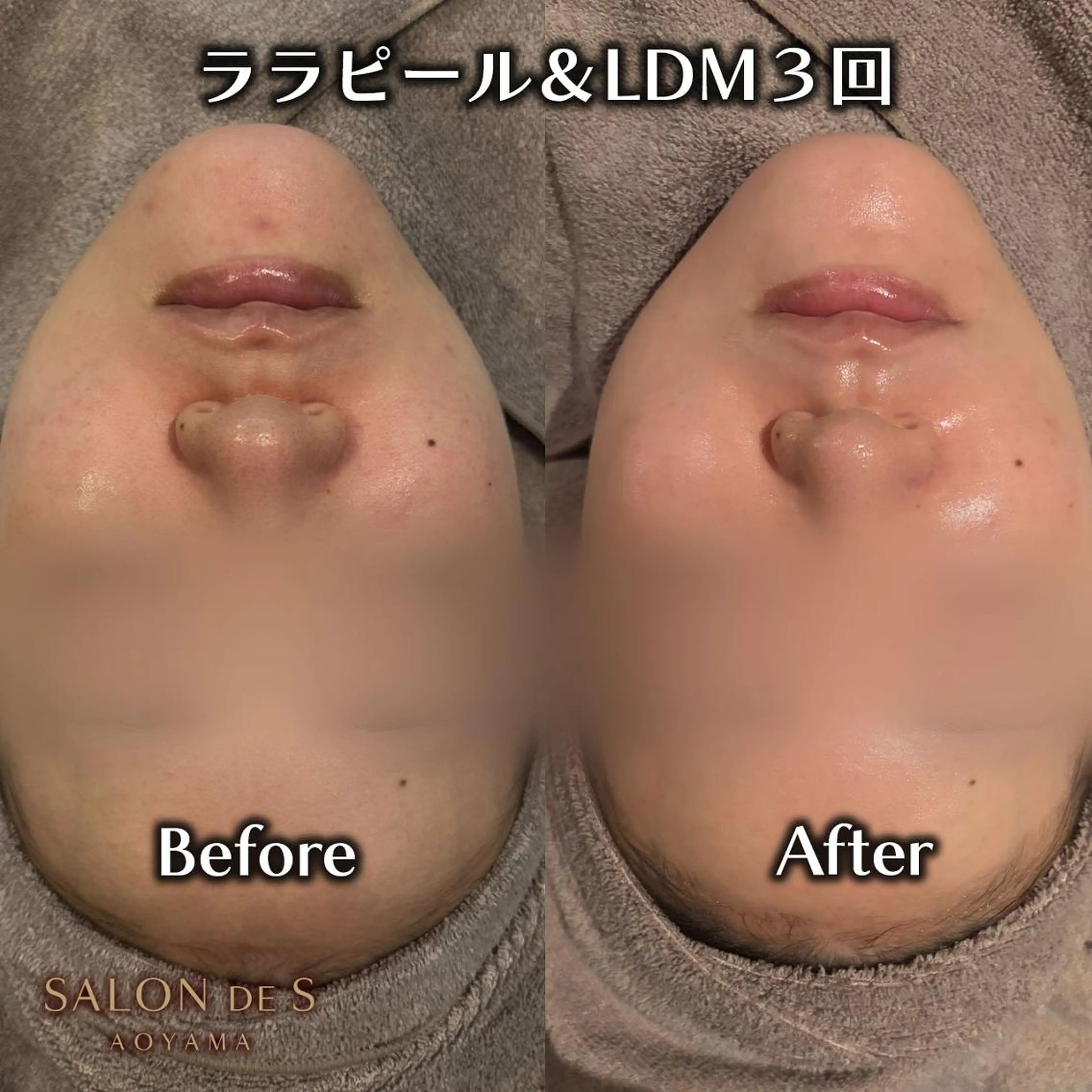 エステ SALON DE S 外苑前♡さやかのエステ・リラクイメージ