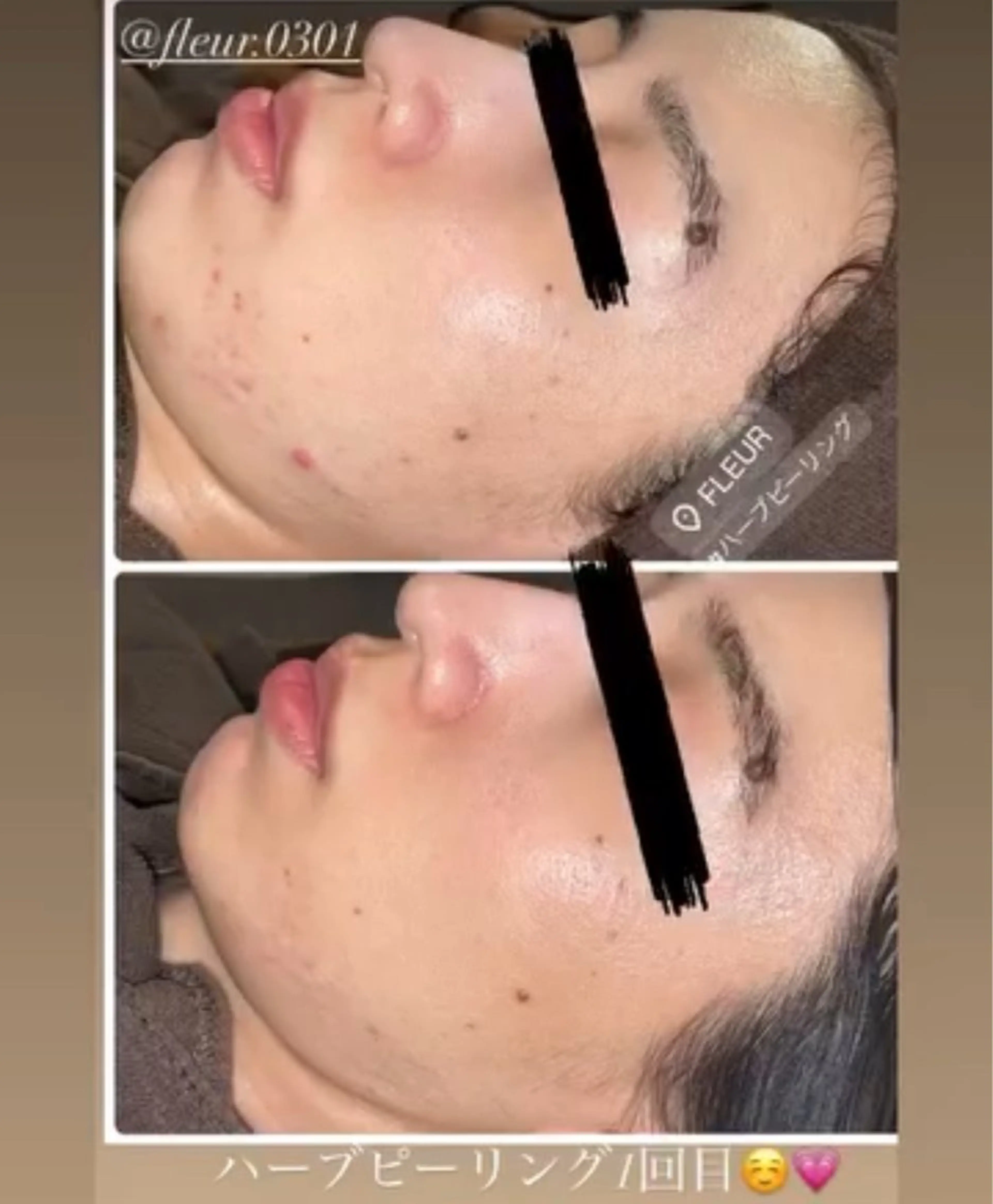 FLEUR 2号店のエステ・リラクイメージ