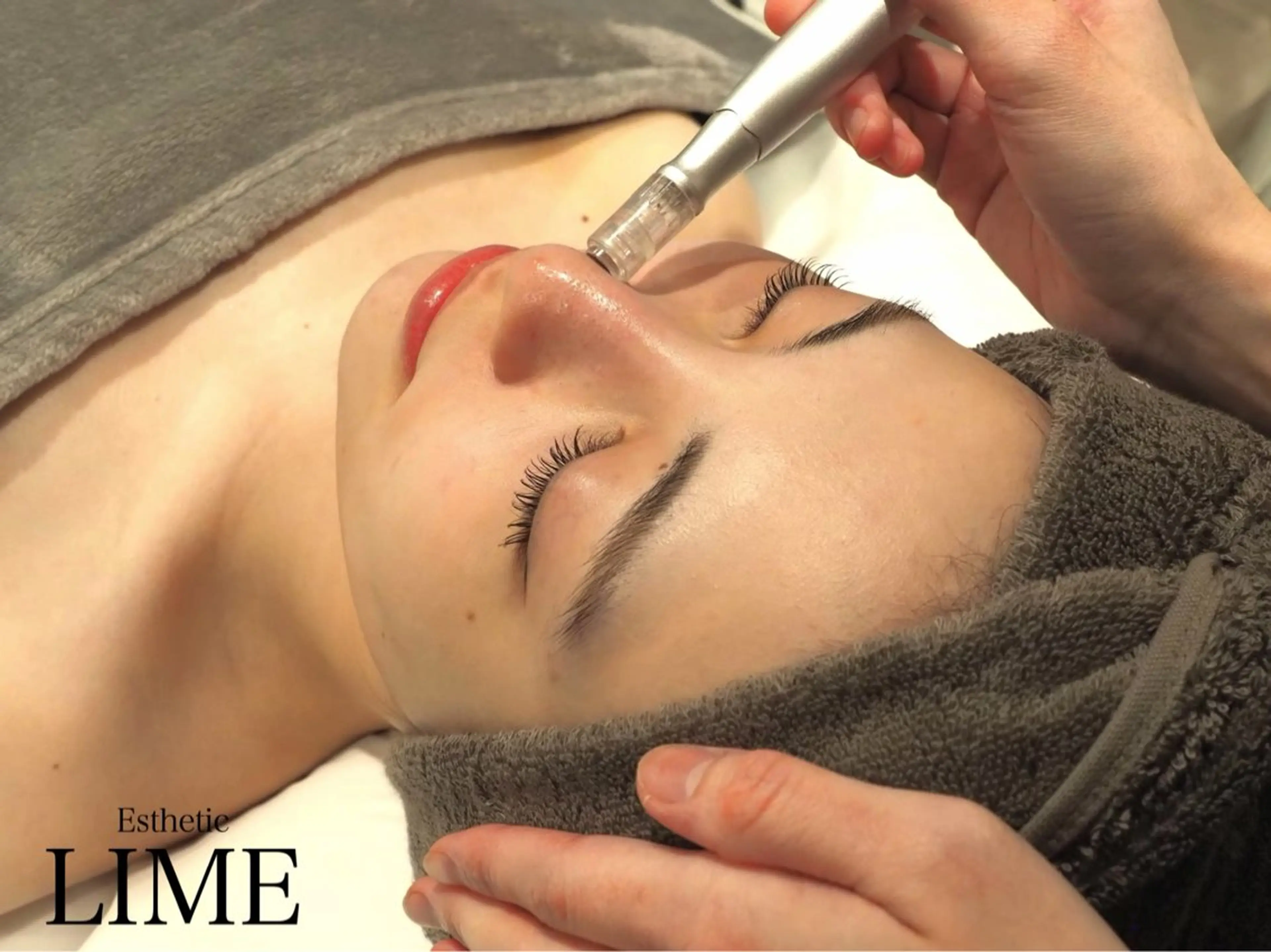 【ニキビケア|凹凸肌向け】 韓国式美肌ケア×高濃度ビタミンパックの写真