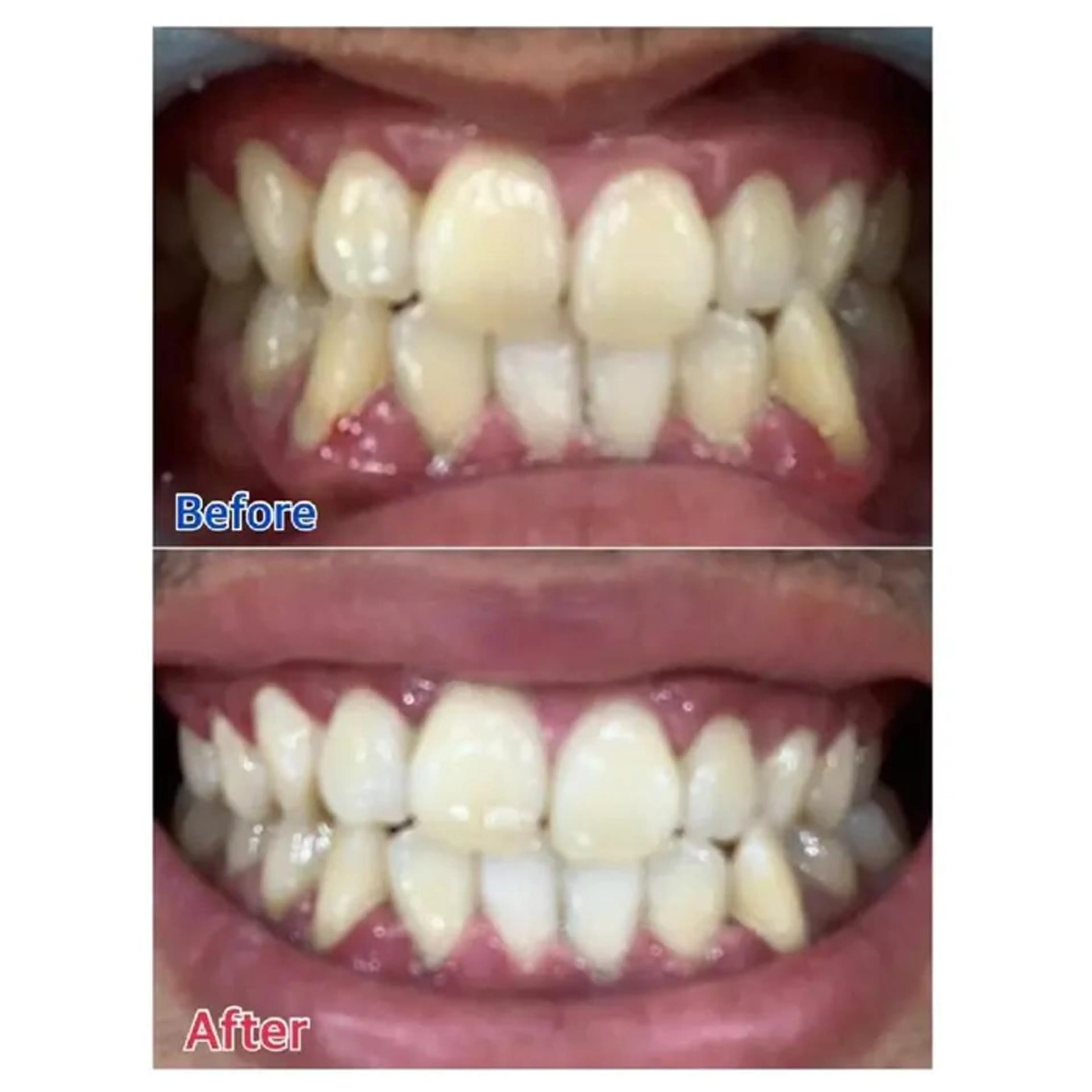 M渋谷 ホワイトニングのエステ・リラクイメージ