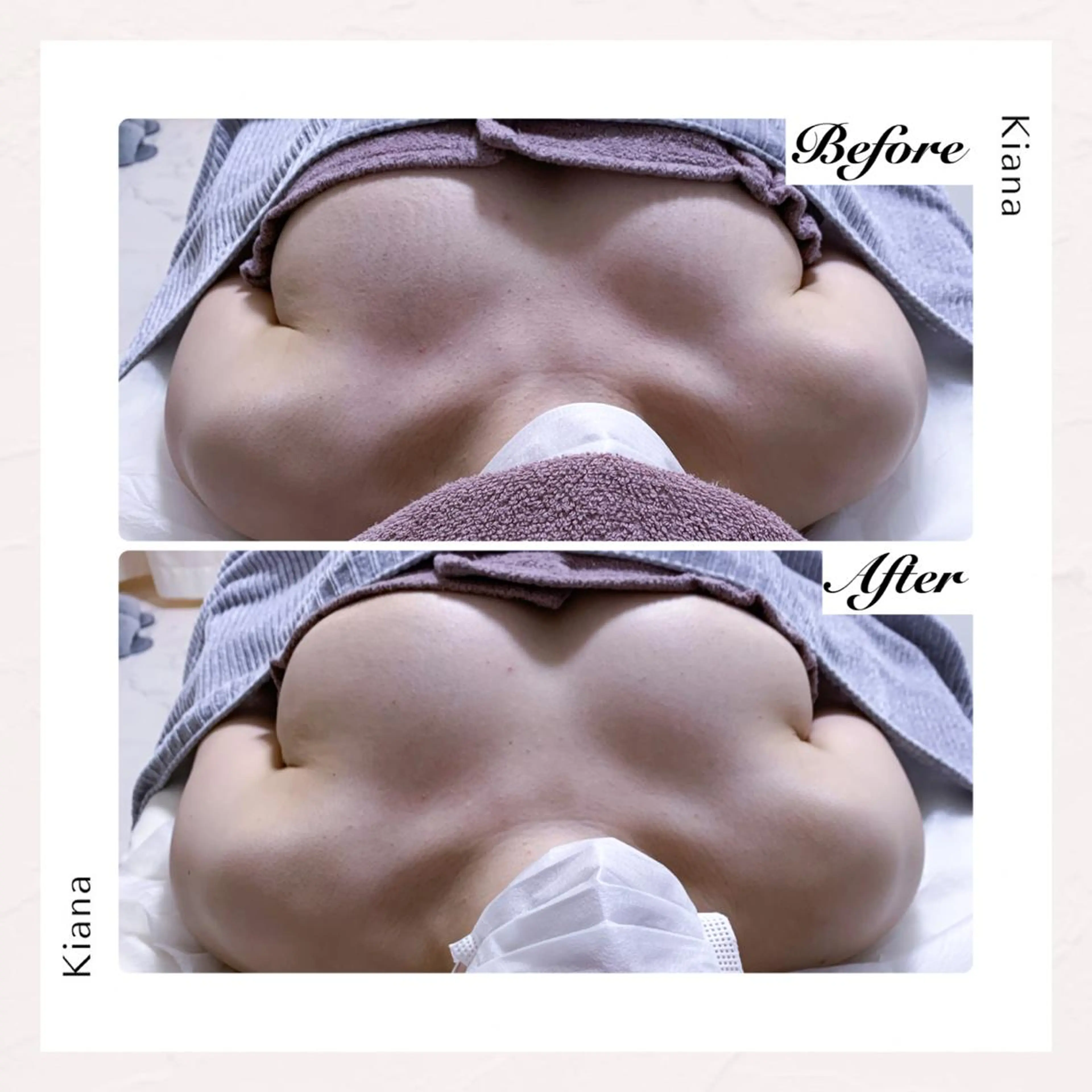 バスト専門Kiana 風のエステ・リラクイメージ