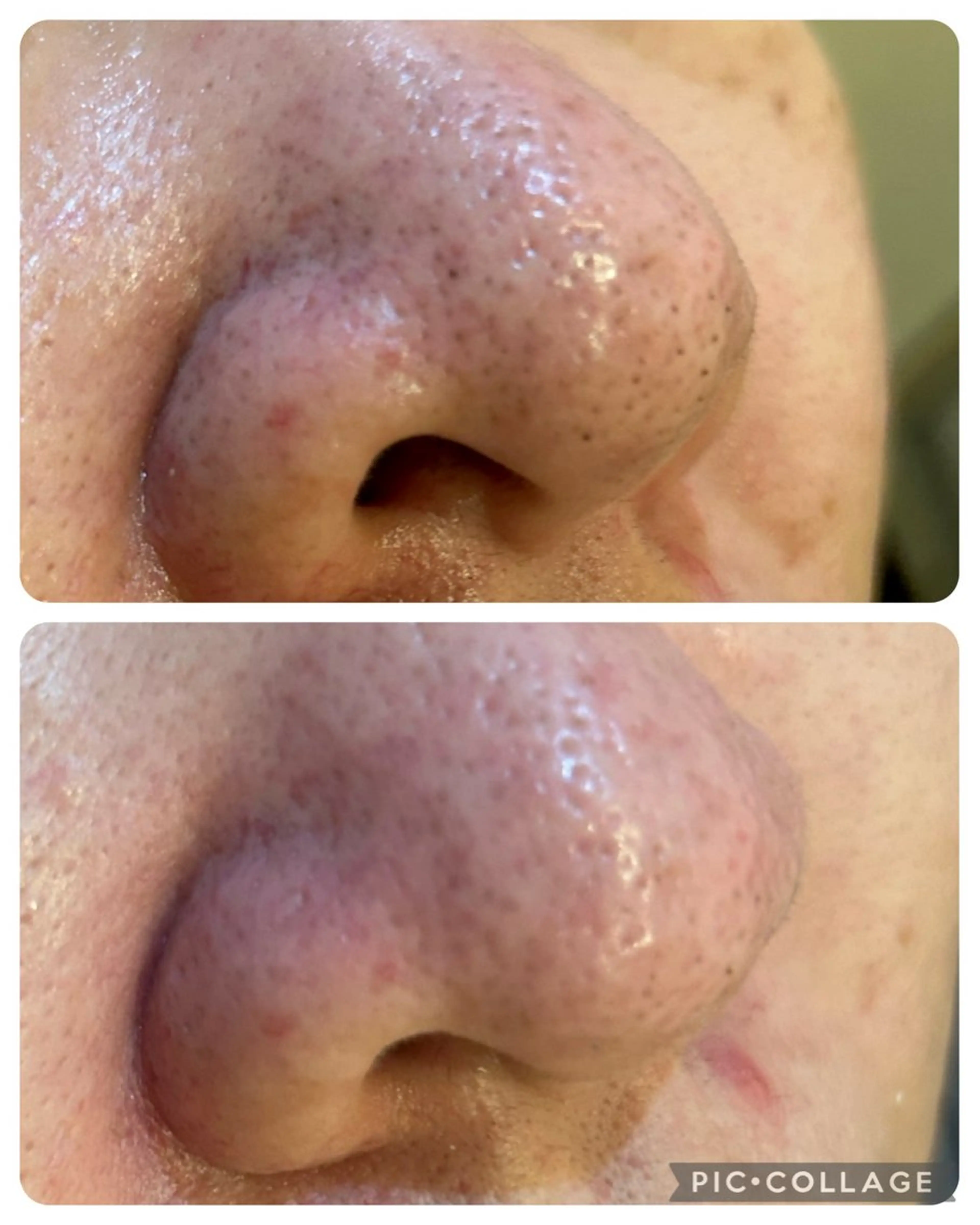 エステ デアイム岩槻 ナリス化粧品所属・✨小山 美穂✨のその他イメージ