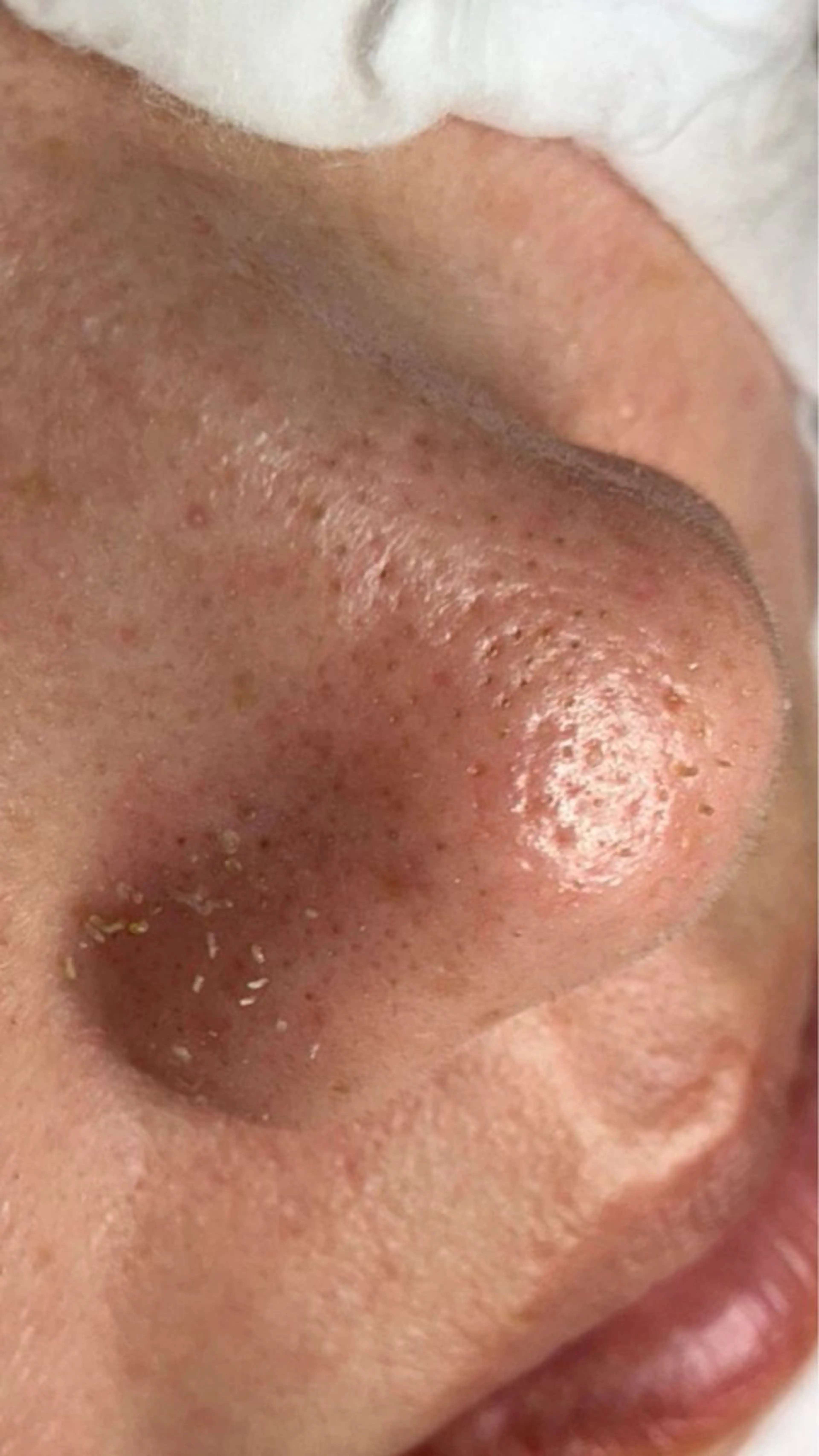 毛穴肌質ケアサロン Yourmeユアミーのエステ・リラクイメージ