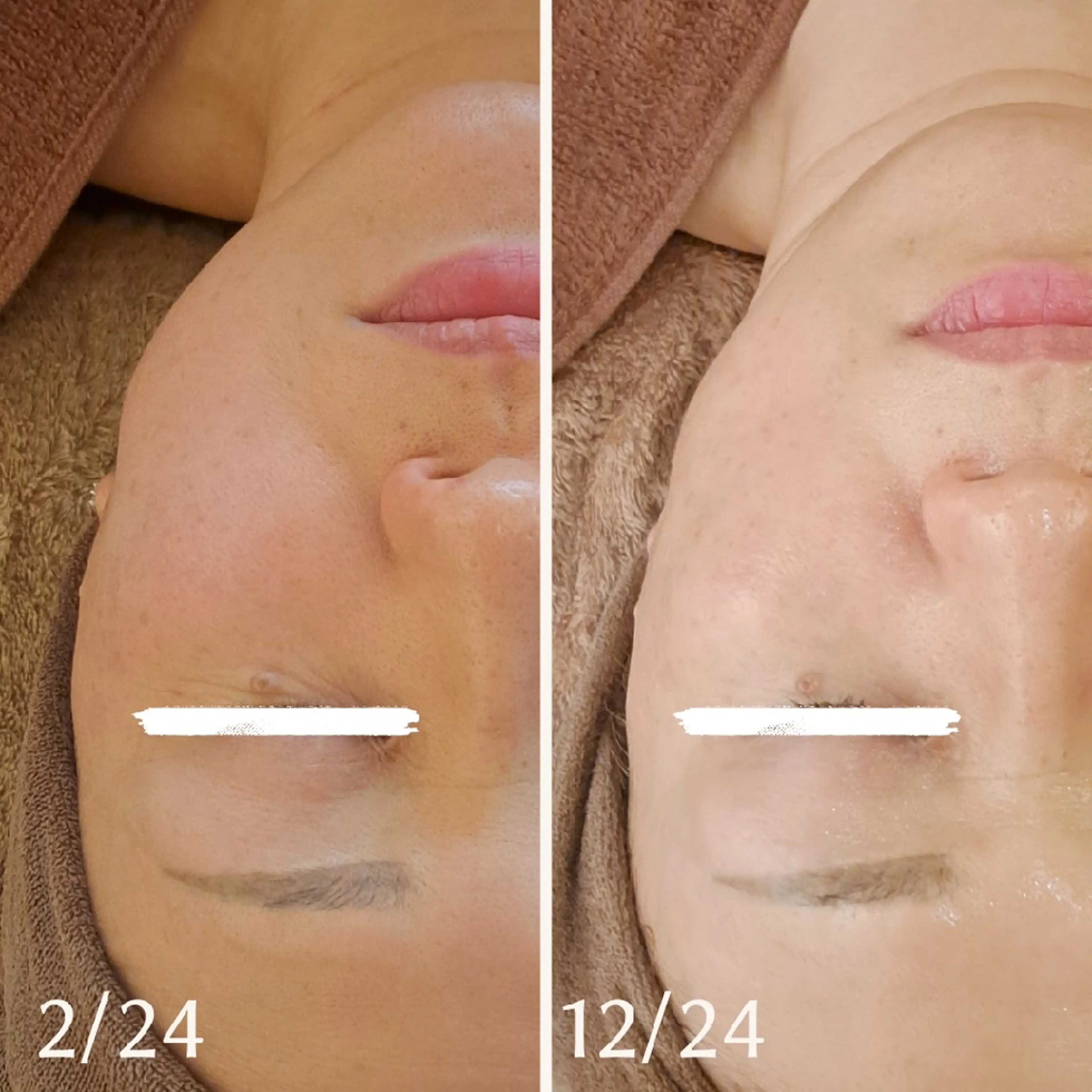 エステ リラク 美容鍼×エステ　鍼灸 サロンmiyabiのエステ・リラクイメージ