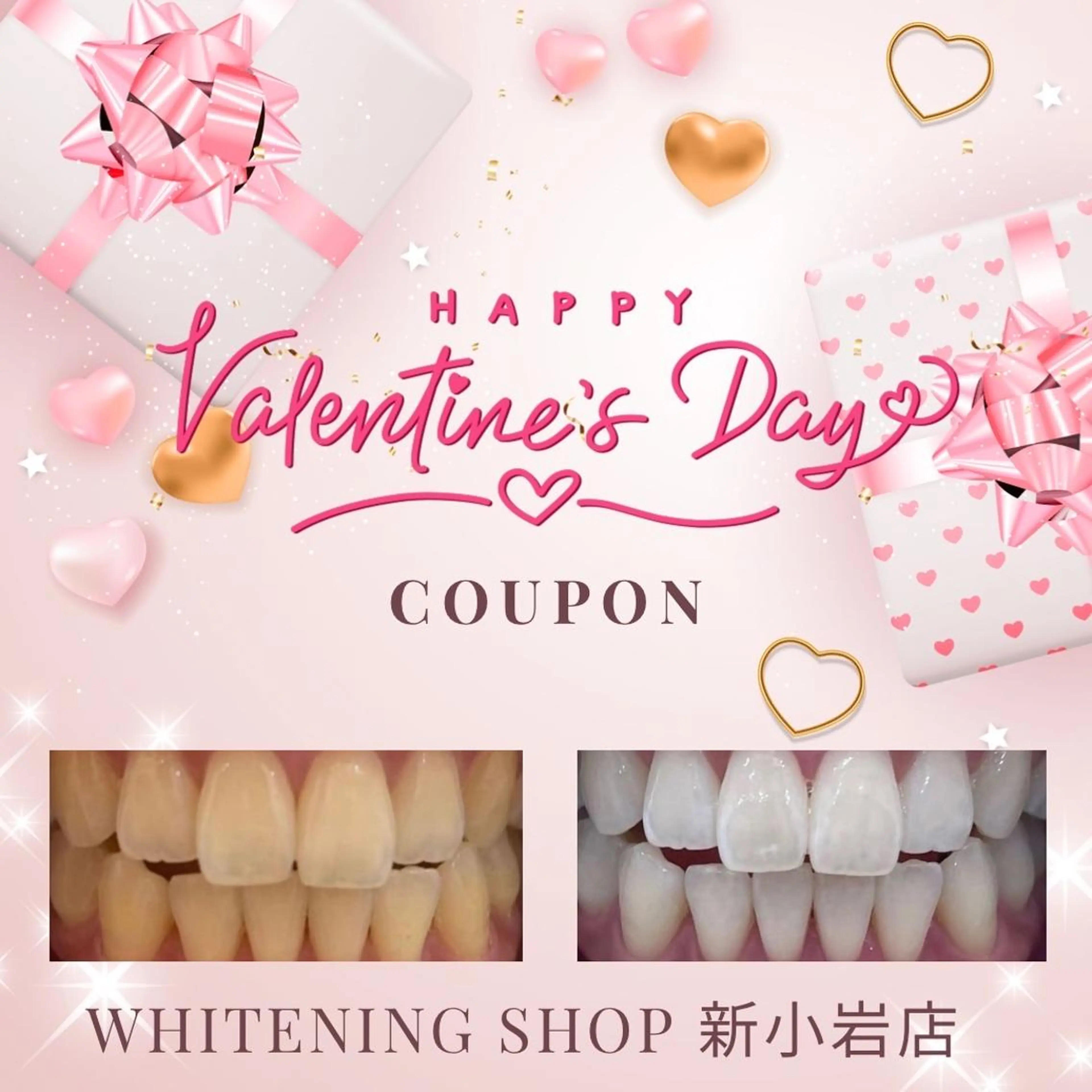 メンズ その他 ホワイトニング ショップ新小岩店のその他イメージ