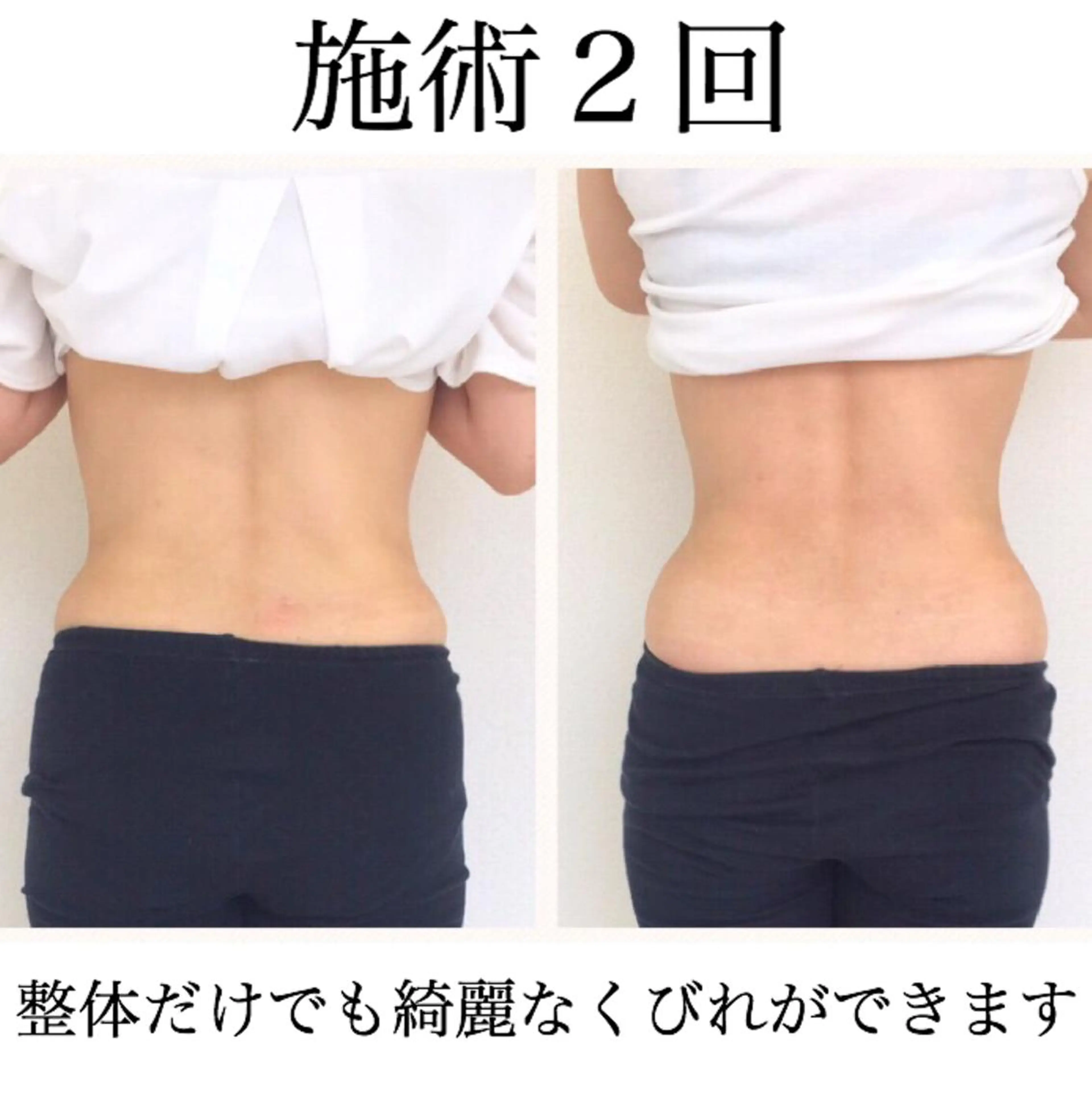 小顔モニター 募集のエステ・リラクイメージ