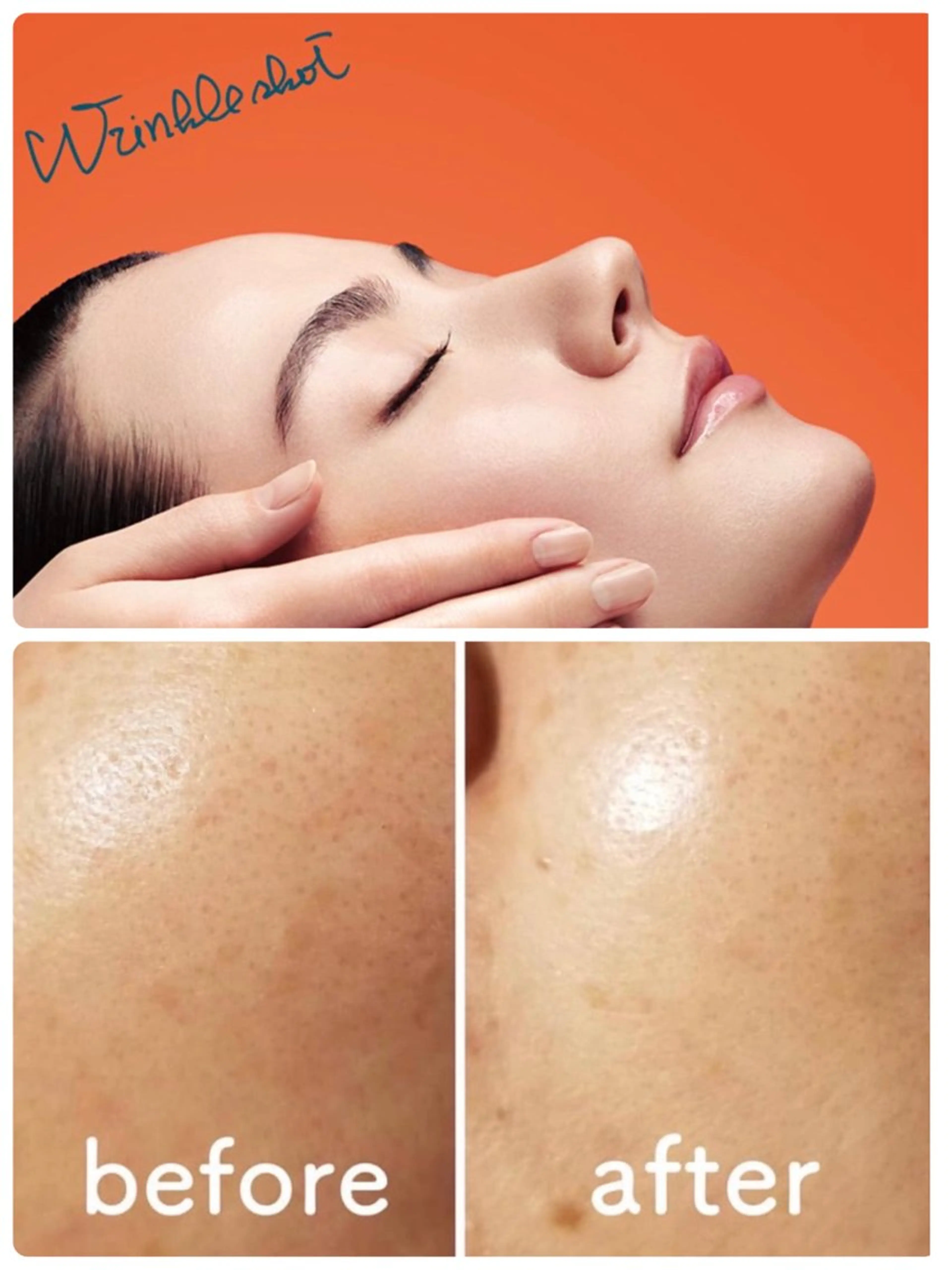 エステ リラク 小顔毛穴✨✨ POLA弥富駅前店のエステ・リラクイメージ