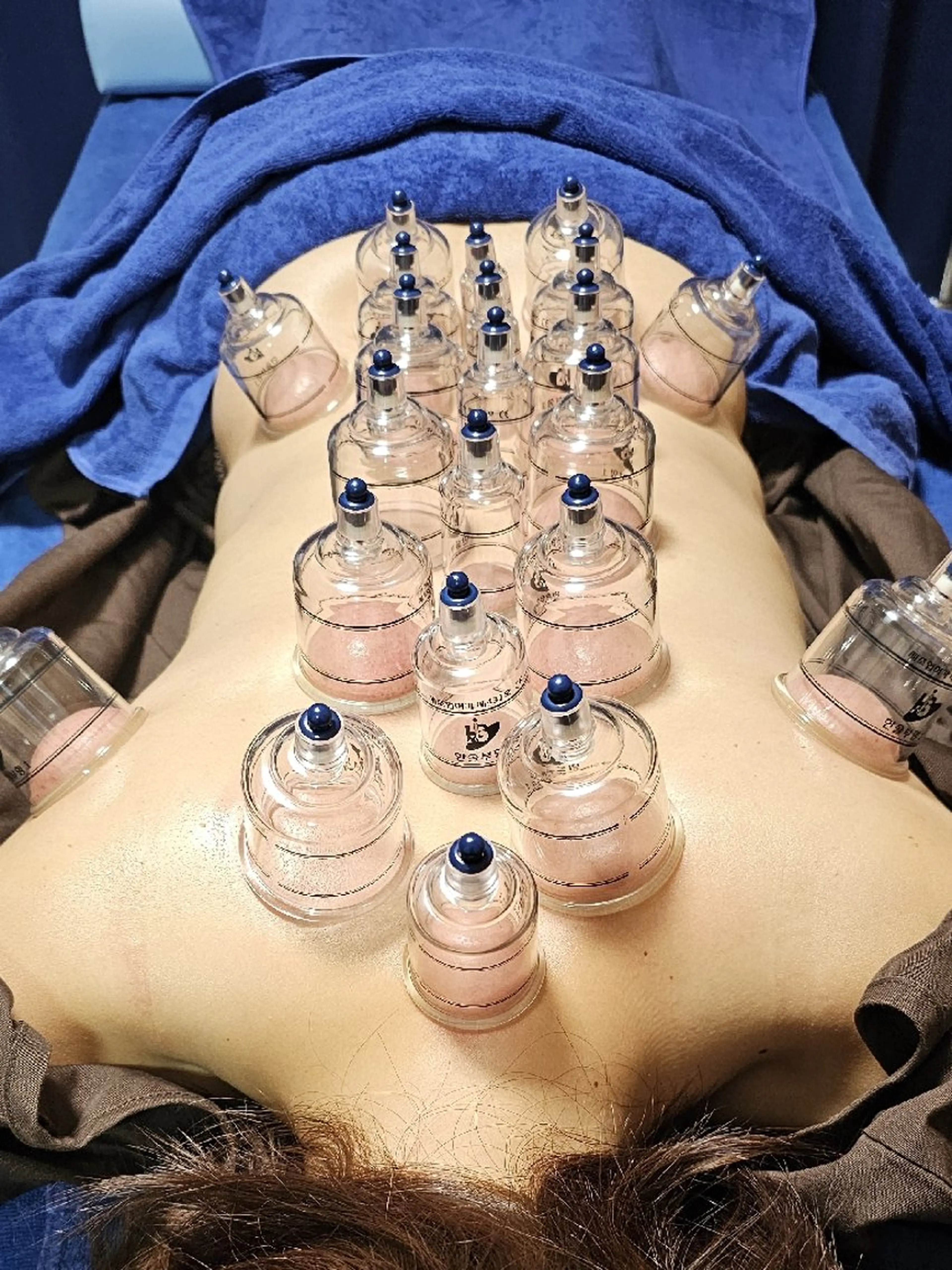 鍼灸整体院アレンジ所属・鍼灸整体院 アレンジのその他イメージ