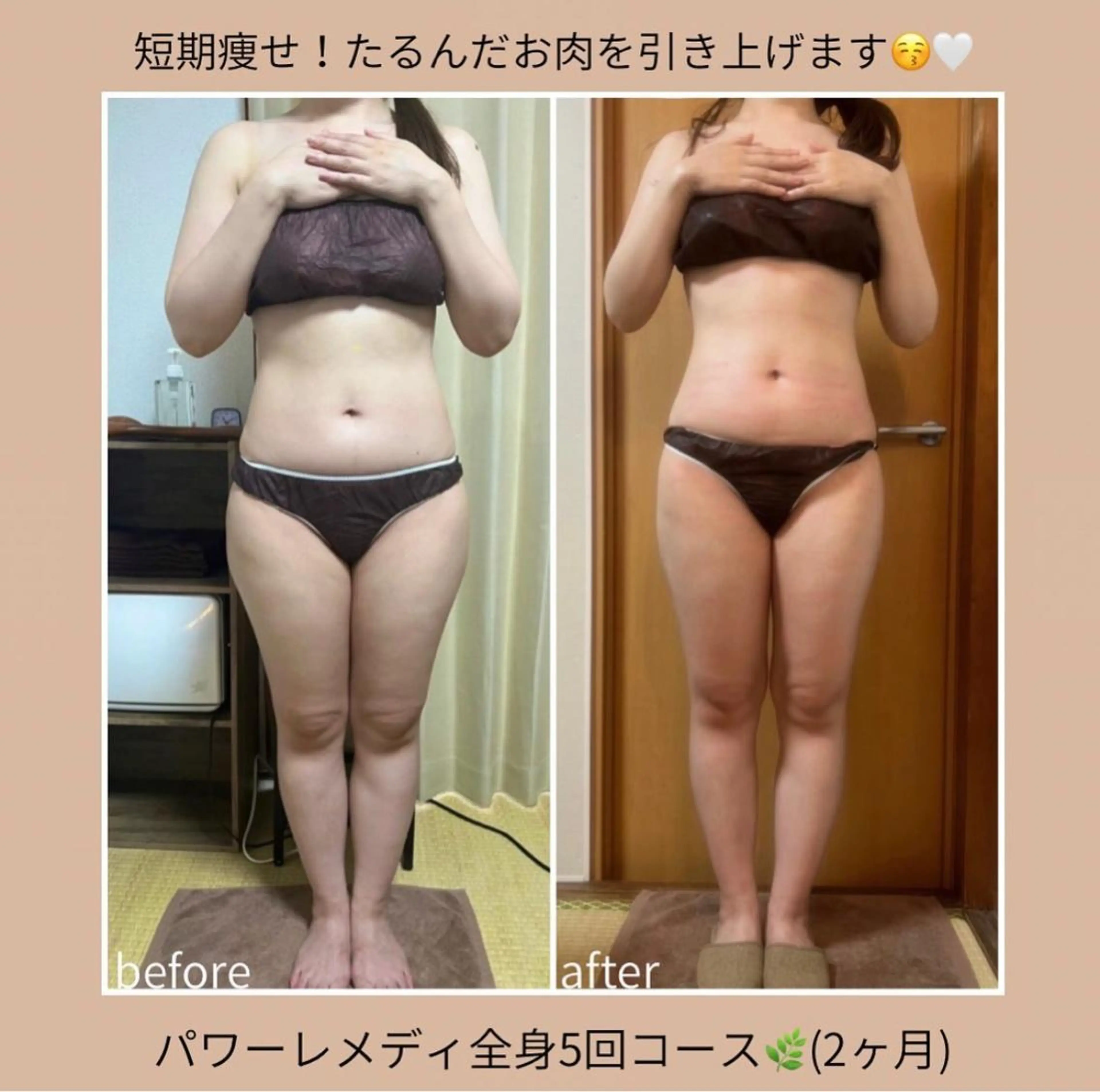 《本気痩せ×疲労改善 》  BILOOPのエステ・リラクイメージ