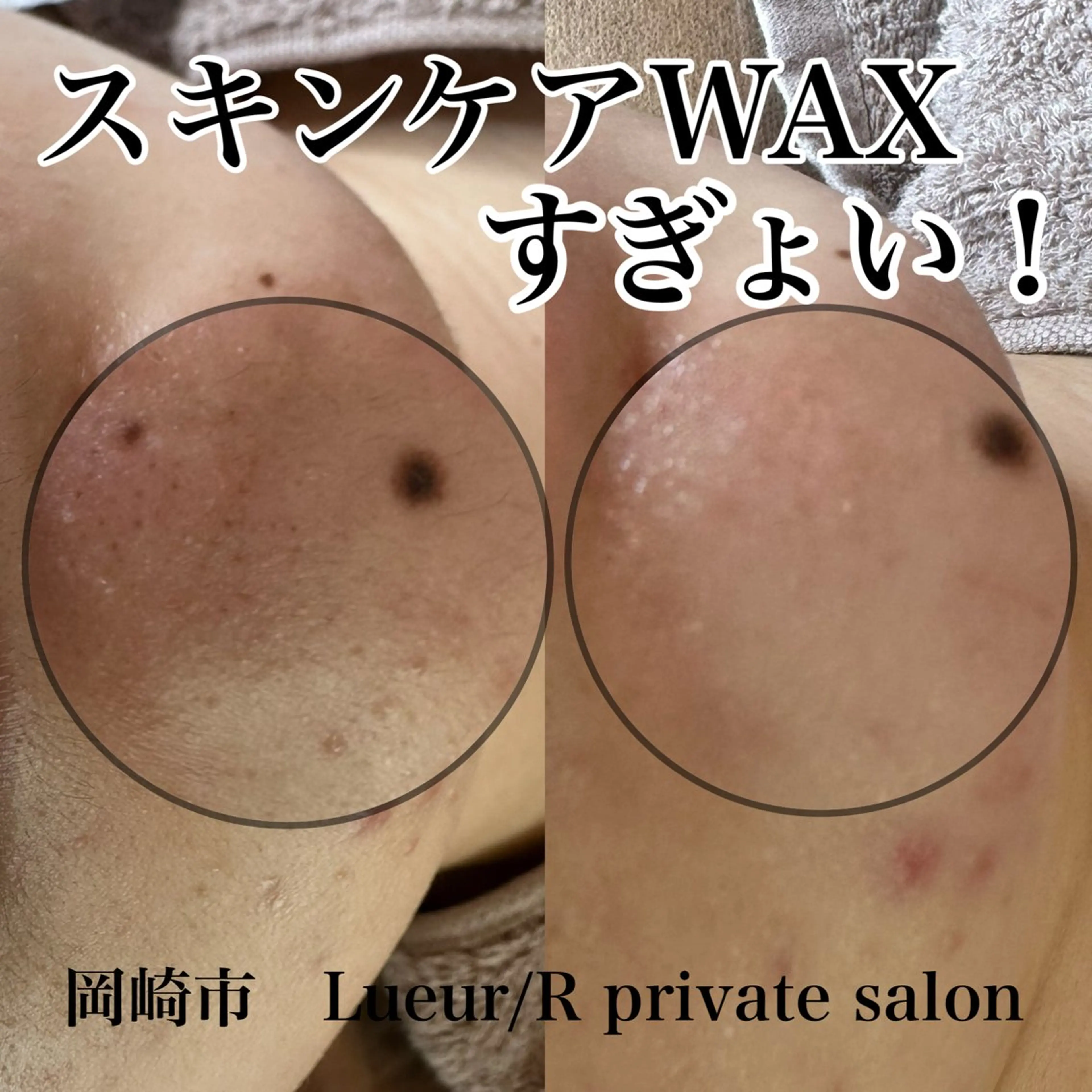 その他 大久保 里奈のエステ・リラクイメージ