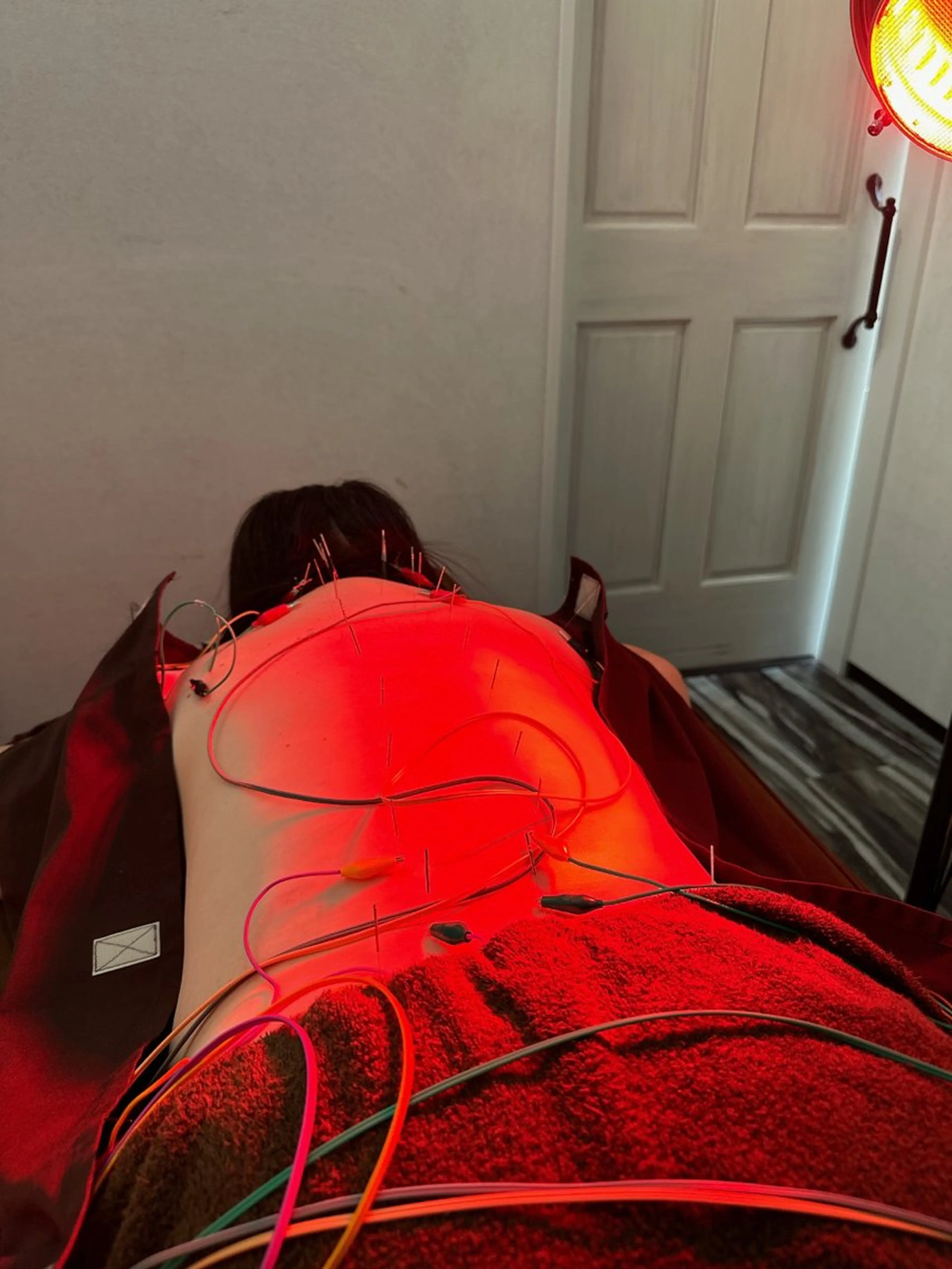 その他 小顔矯/美容鍼/鍼灸 BeauJuのその他イメージ