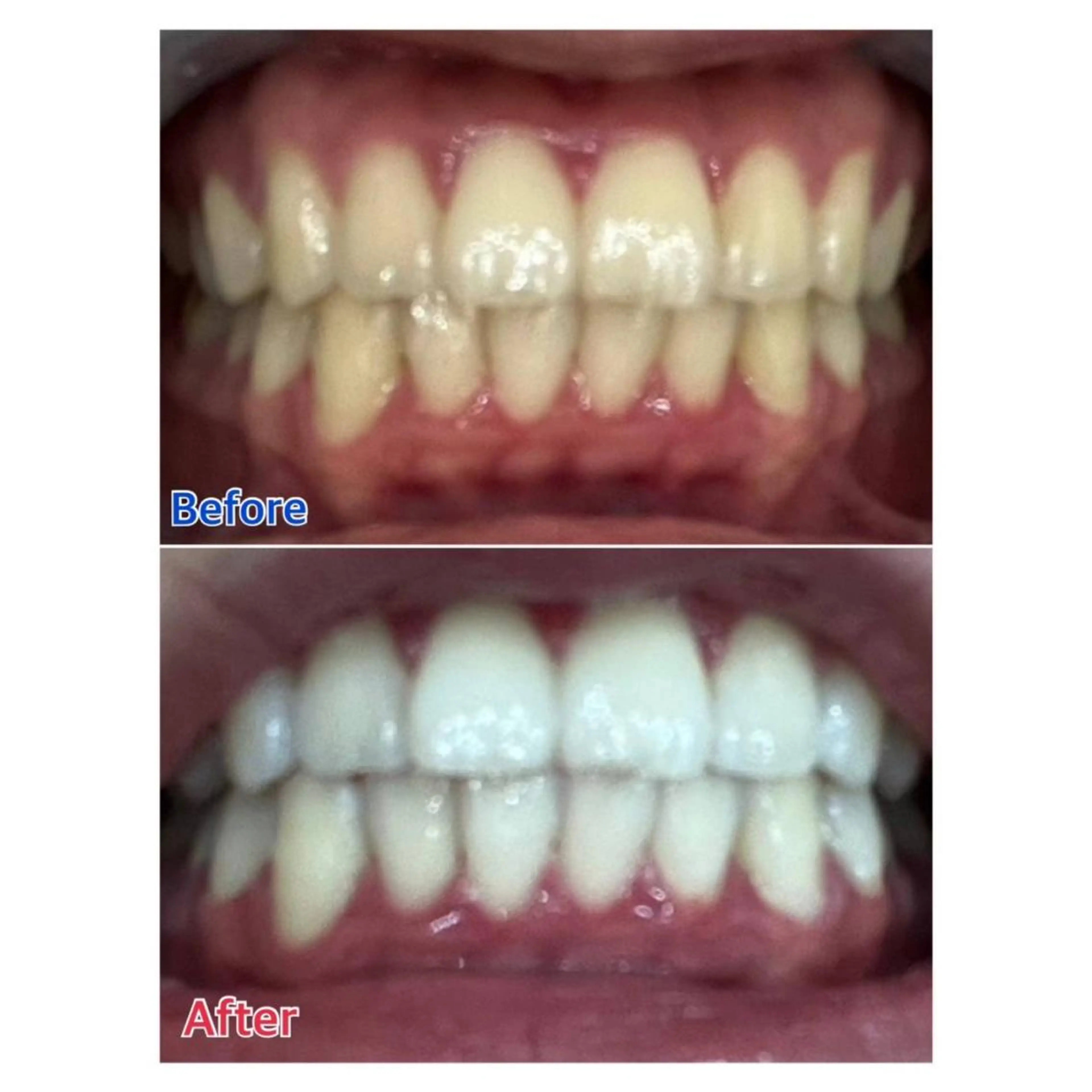 MBEAUTYSALON 千葉店・京成大久保所属・Melty 輝のその他イメージ