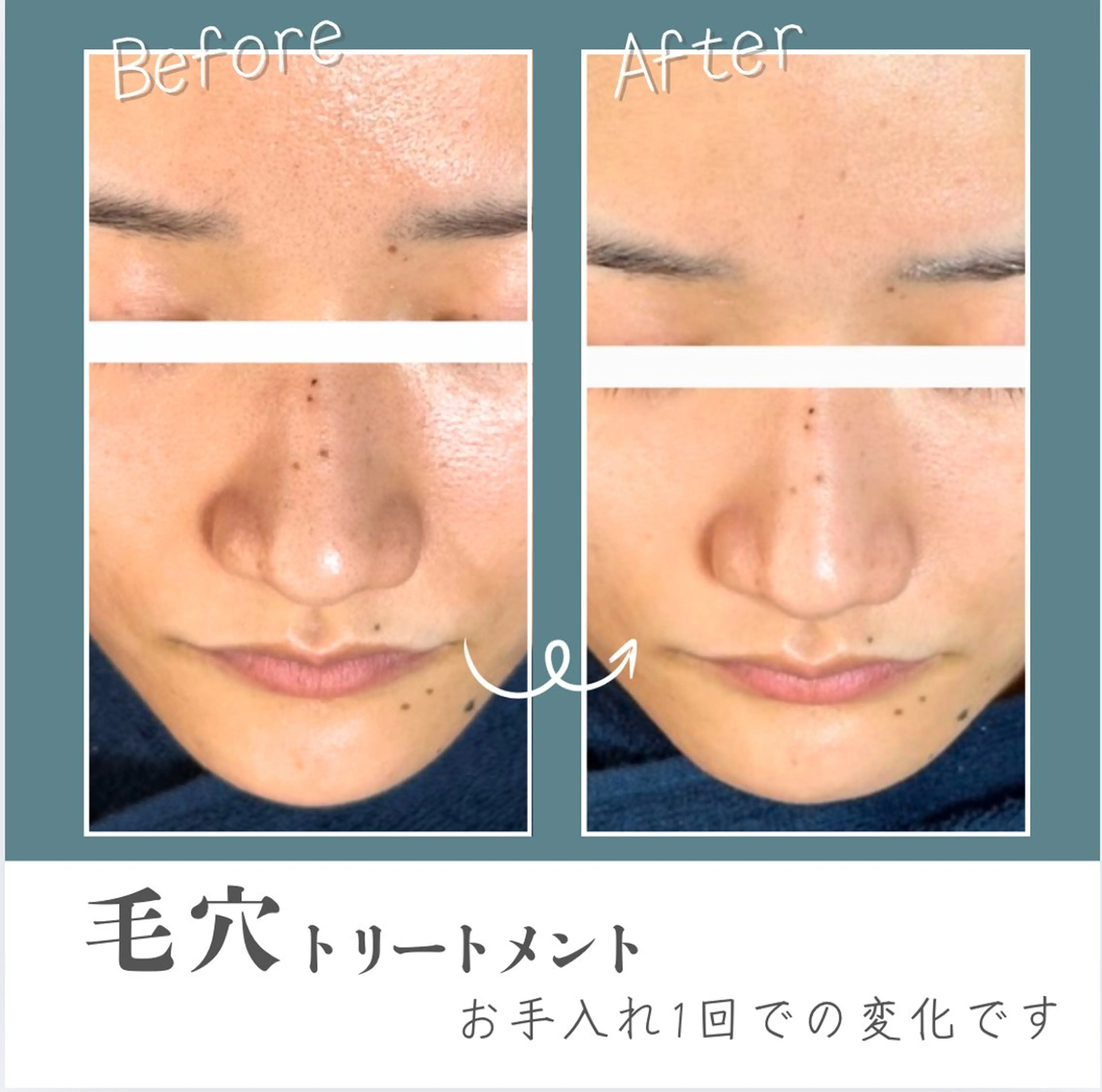 オーガニックサロン ソピヴァのエステ・リラクイメージ