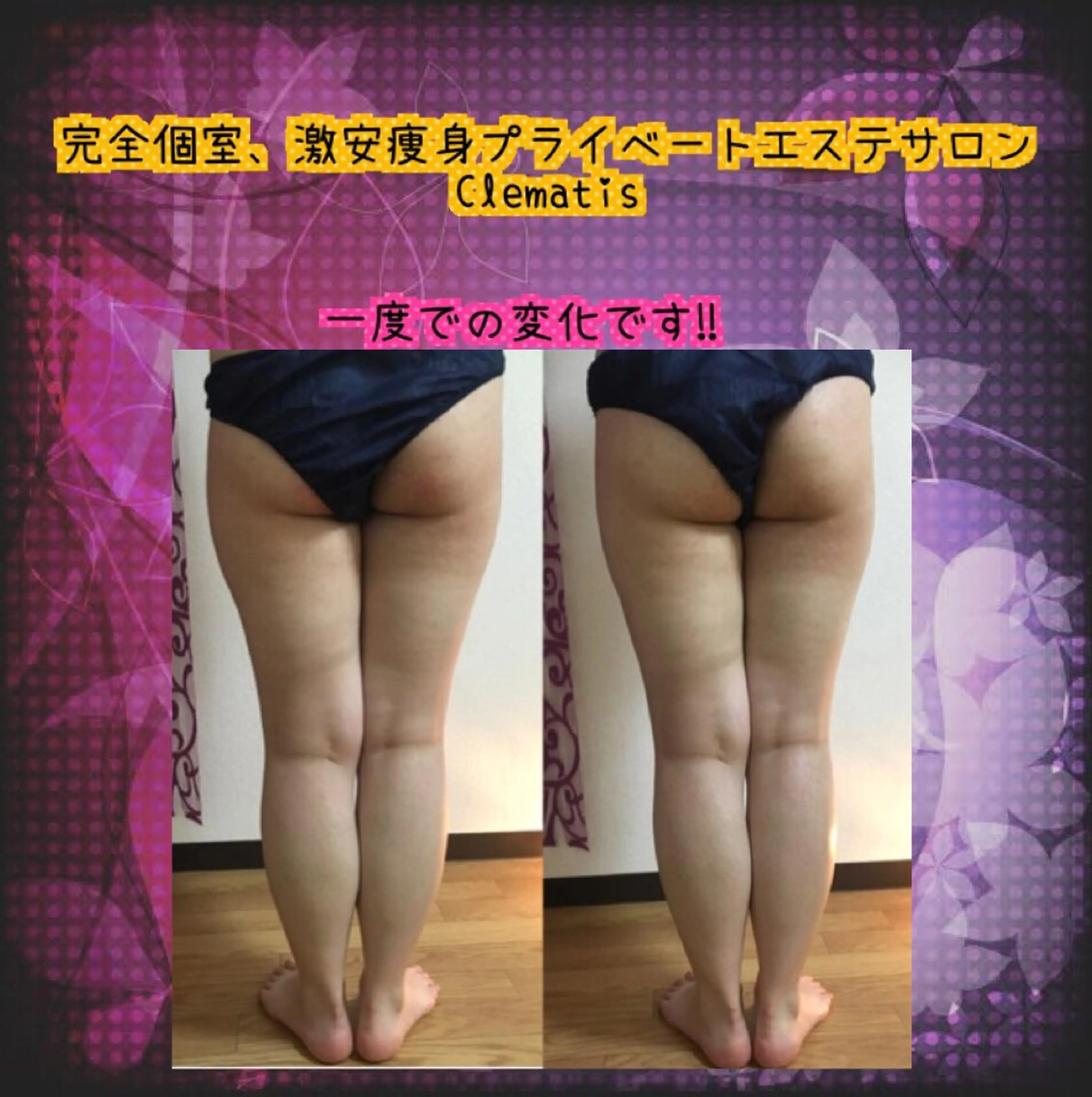 ショート カラー パーマ ヘアアレンジ メンズ キッズ ネイル マツエク・マツパ 強圧オールハンド痩身 片野のエステ・リラクイメージ