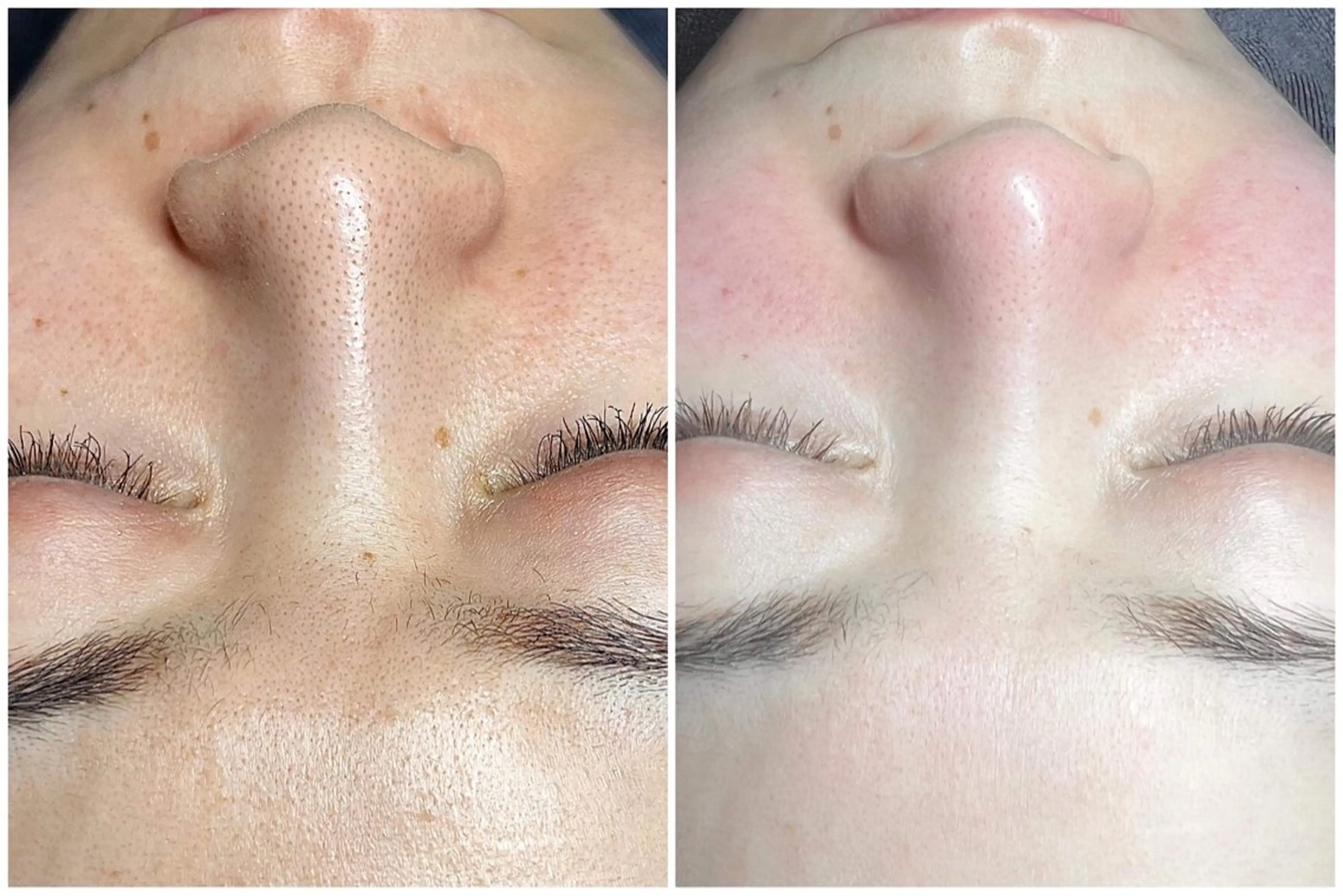 エステ リラク Ri Beauty Spa 川崎のエステ・リラクイメージ