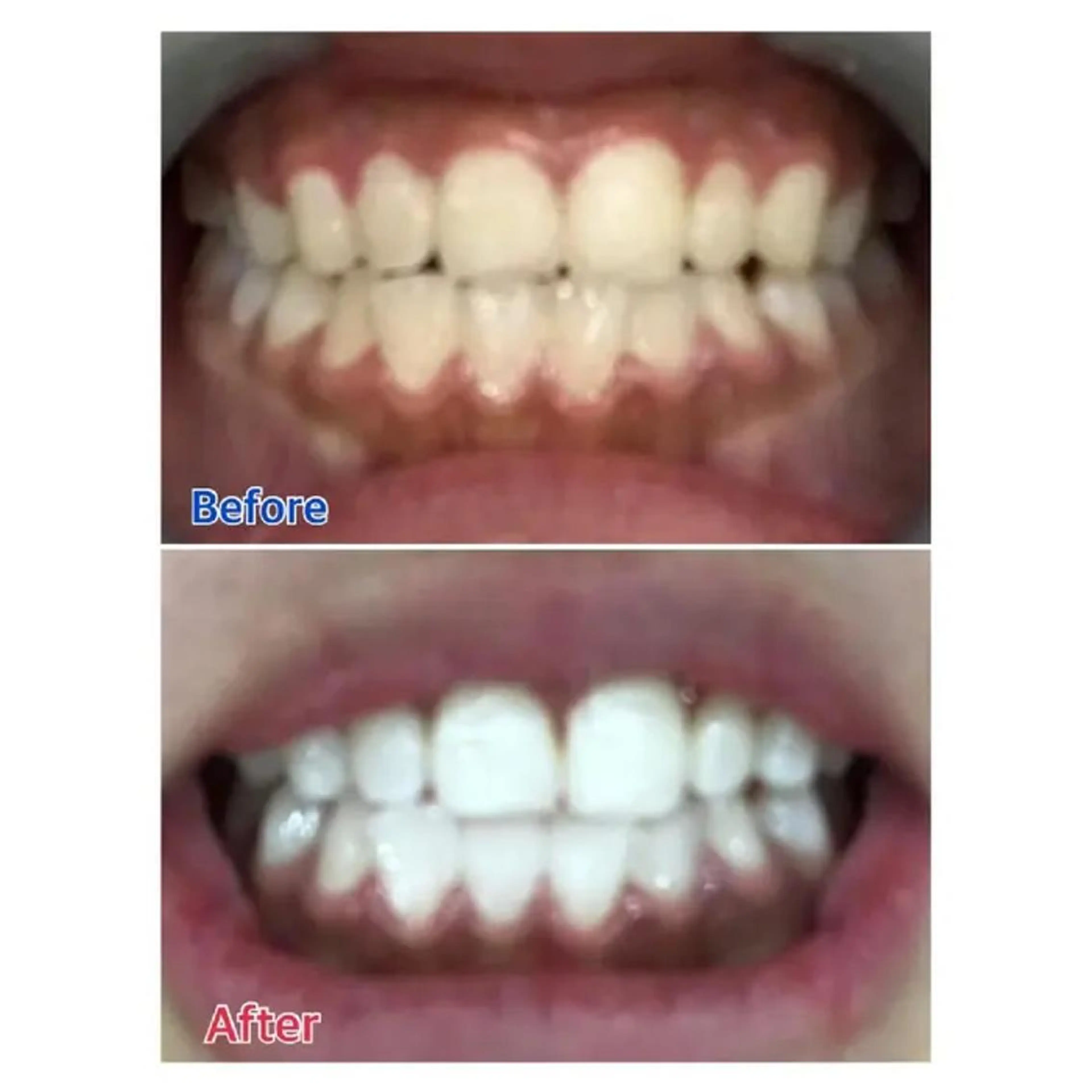 M渋谷 ホワイトニングのエステ・リラクイメージ