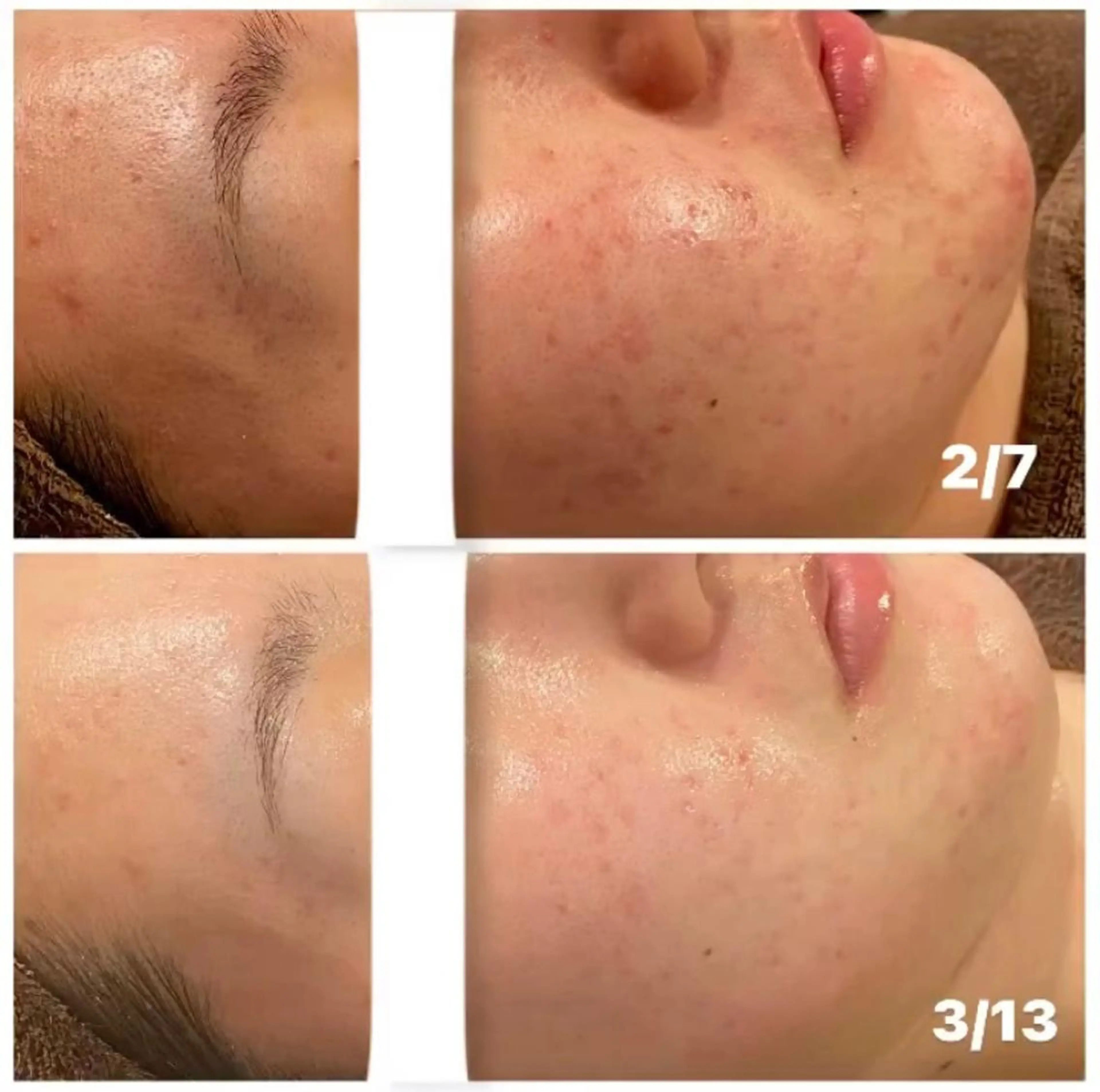 本気の肌質改善スキン デトックス🌿のエステ・リラクイメージ