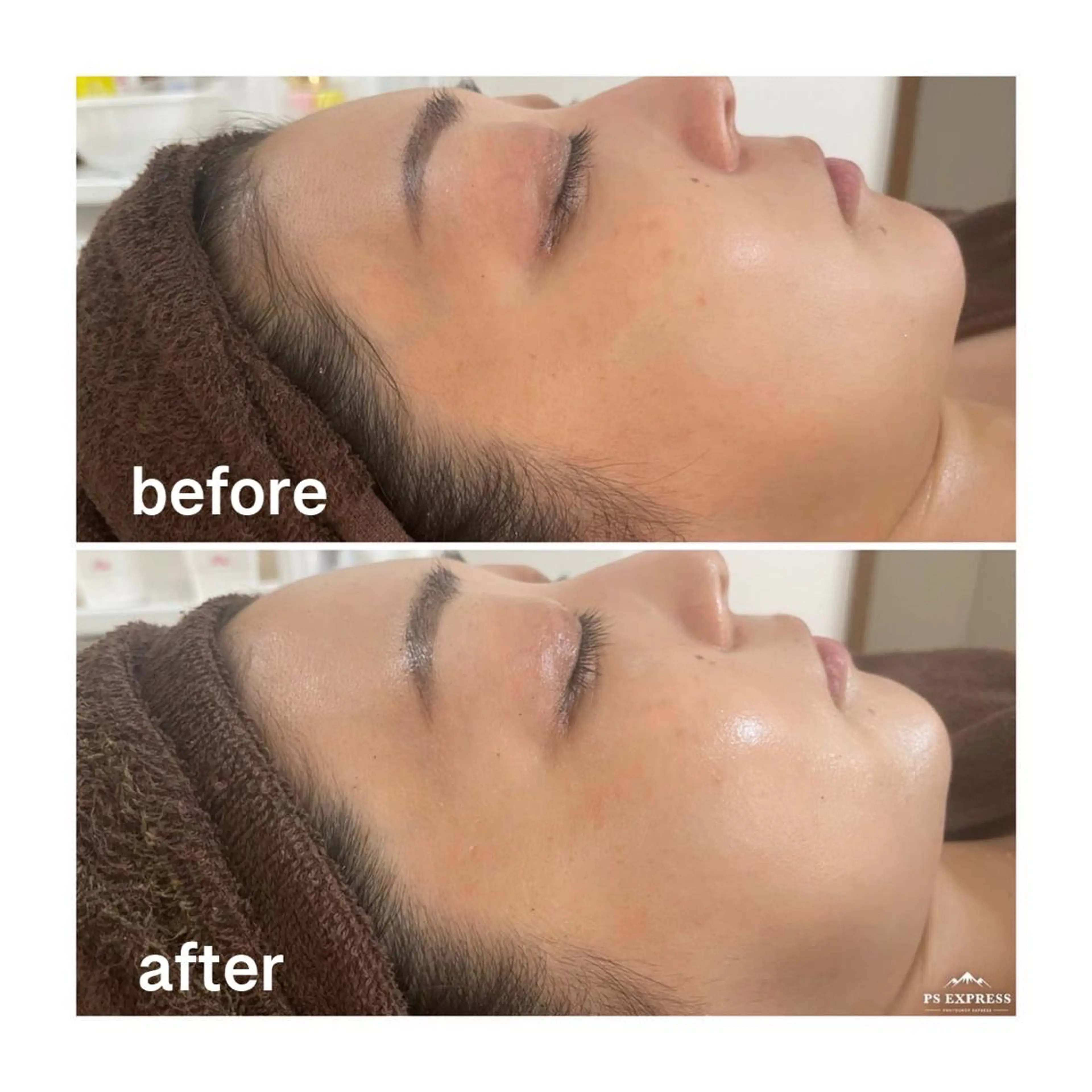 【本格美白✨】憧れ美白しっとり肌🌹陶肌トリートメント+シルクオプション🌹の写真