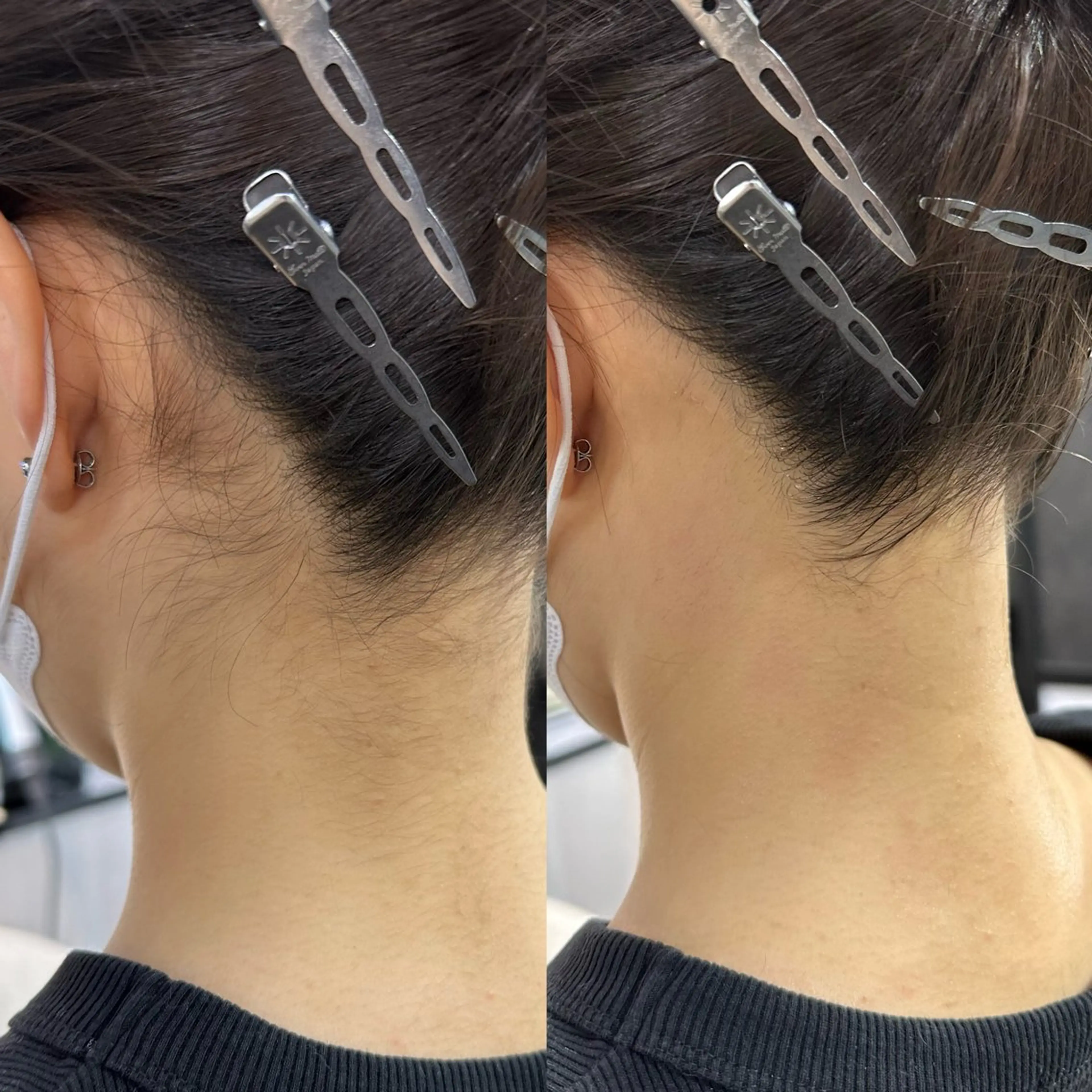 ロング 脱毛 近藤千翔🩵 髪質改善Periodのエステ・リラクイメージ