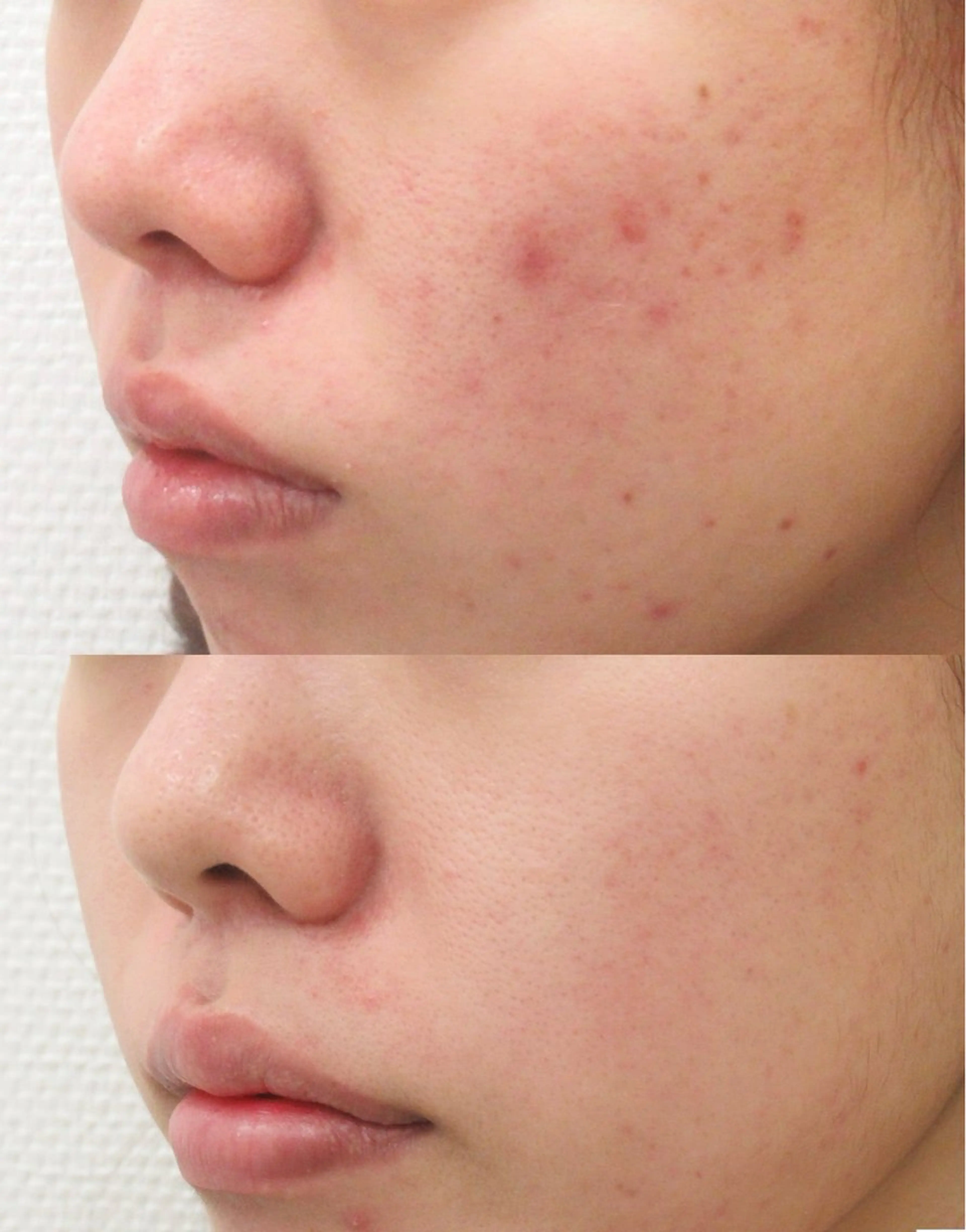 毛穴・美肌専門 〜ﾛｰｽﾞﾄﾞﾒ〜のエステ・リラクイメージ