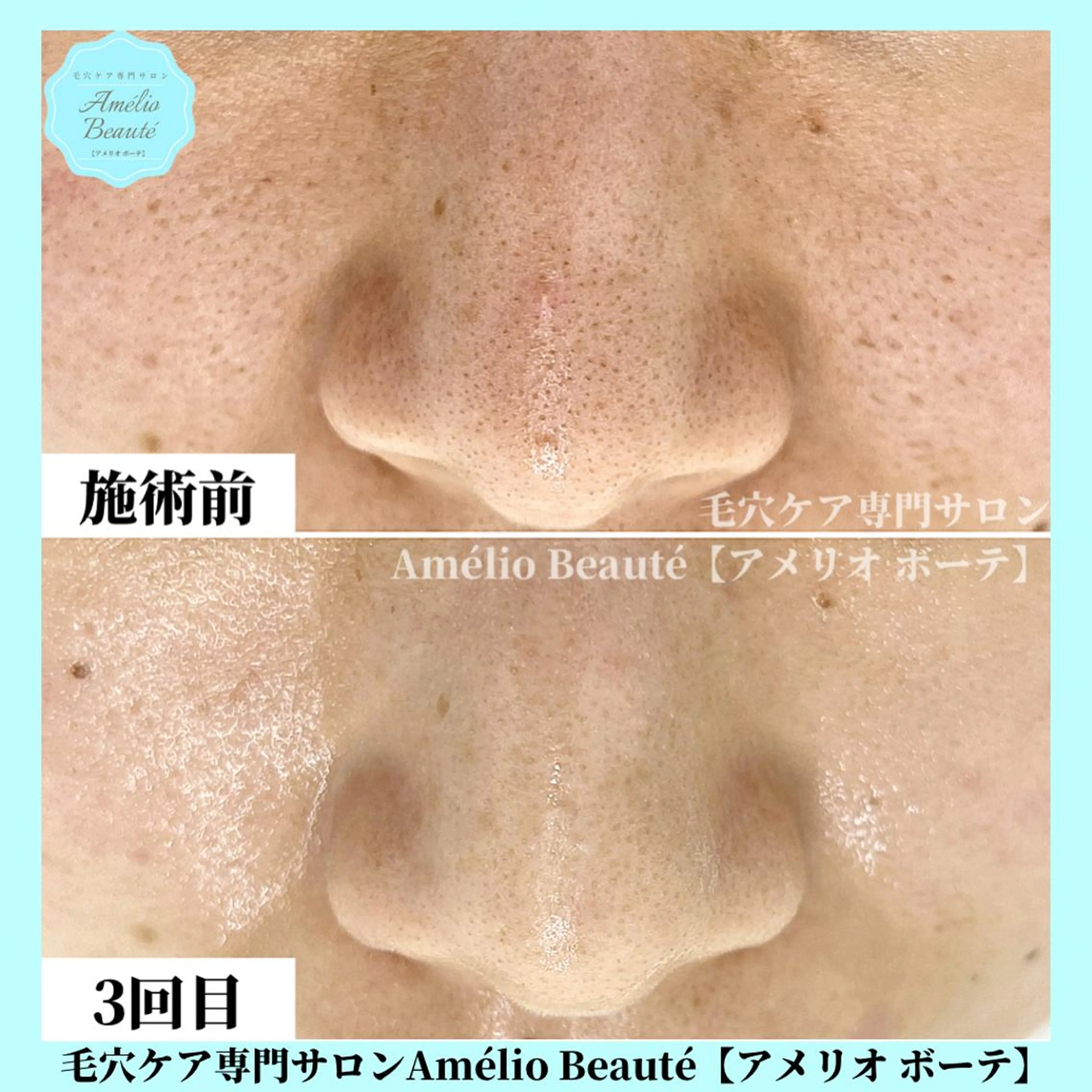 毛穴ケア専門サロン アメリオボーテのその他イメージ