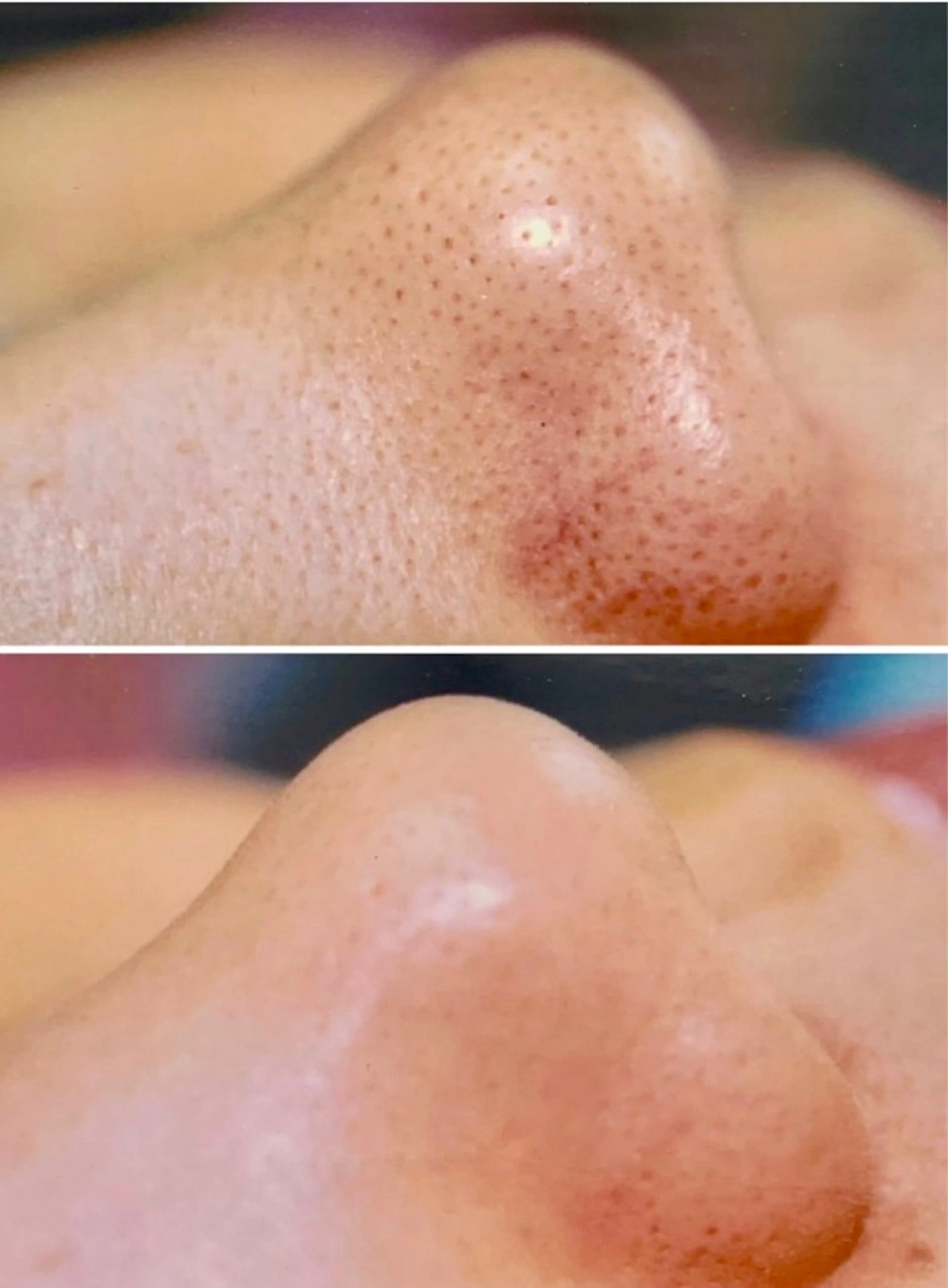 脱毛 メルシー13所属・トータル美容サロン☆ 脱毛/小顔/毛穴洗浄のエステ・リラクイメージ