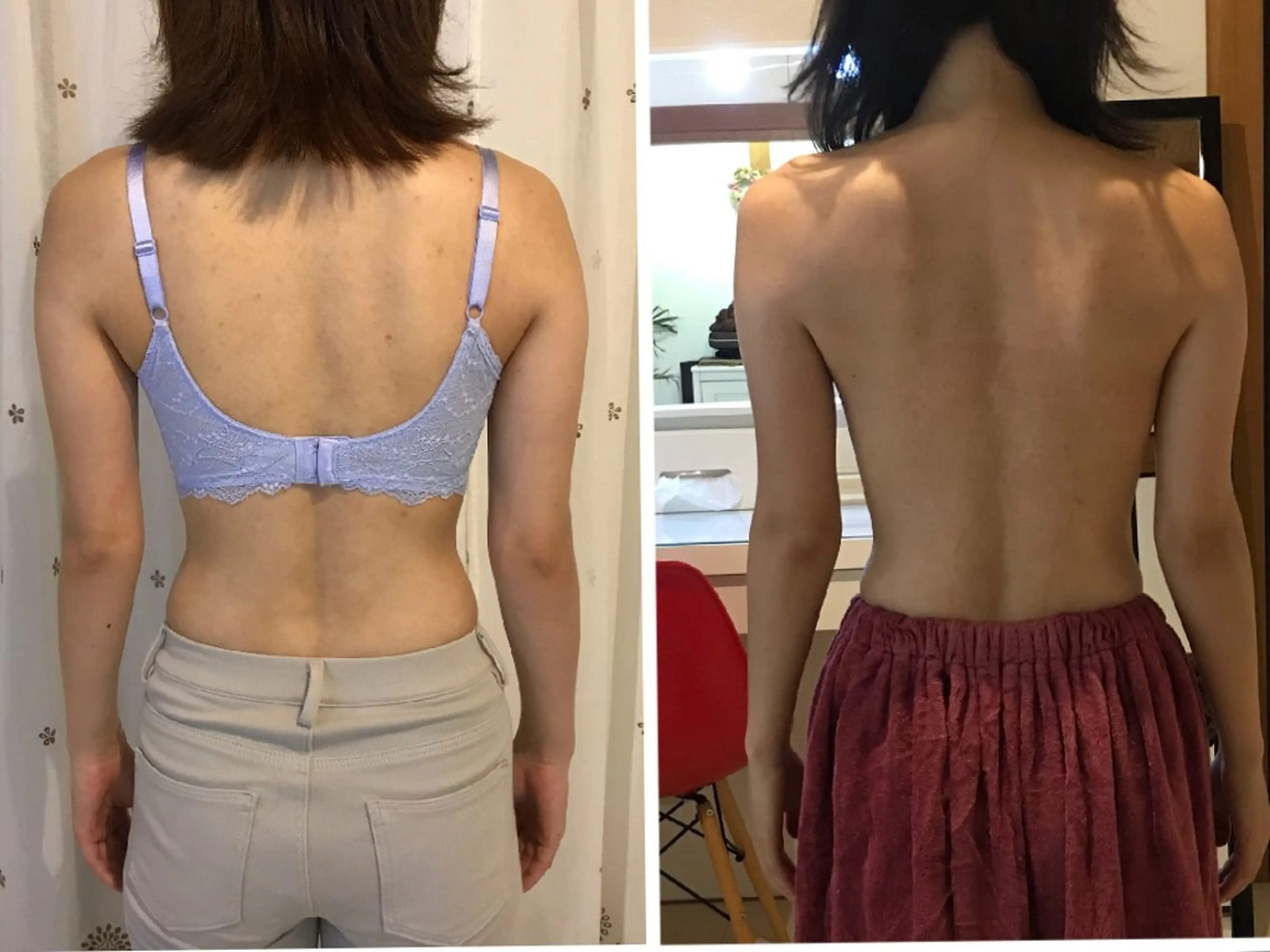 【新規限定】背中・脇肉撃退コースの写真