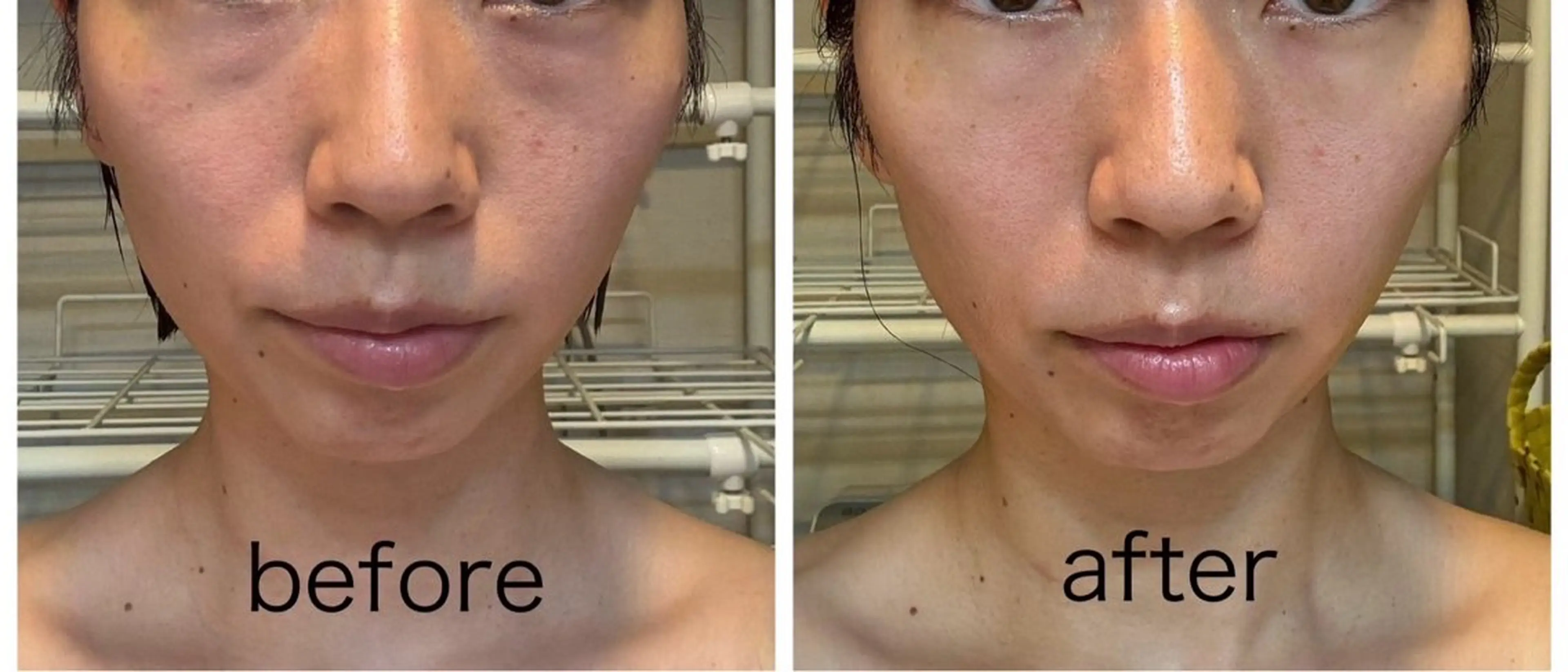 POLA アピタ千代田橋のエステ・リラクイメージ