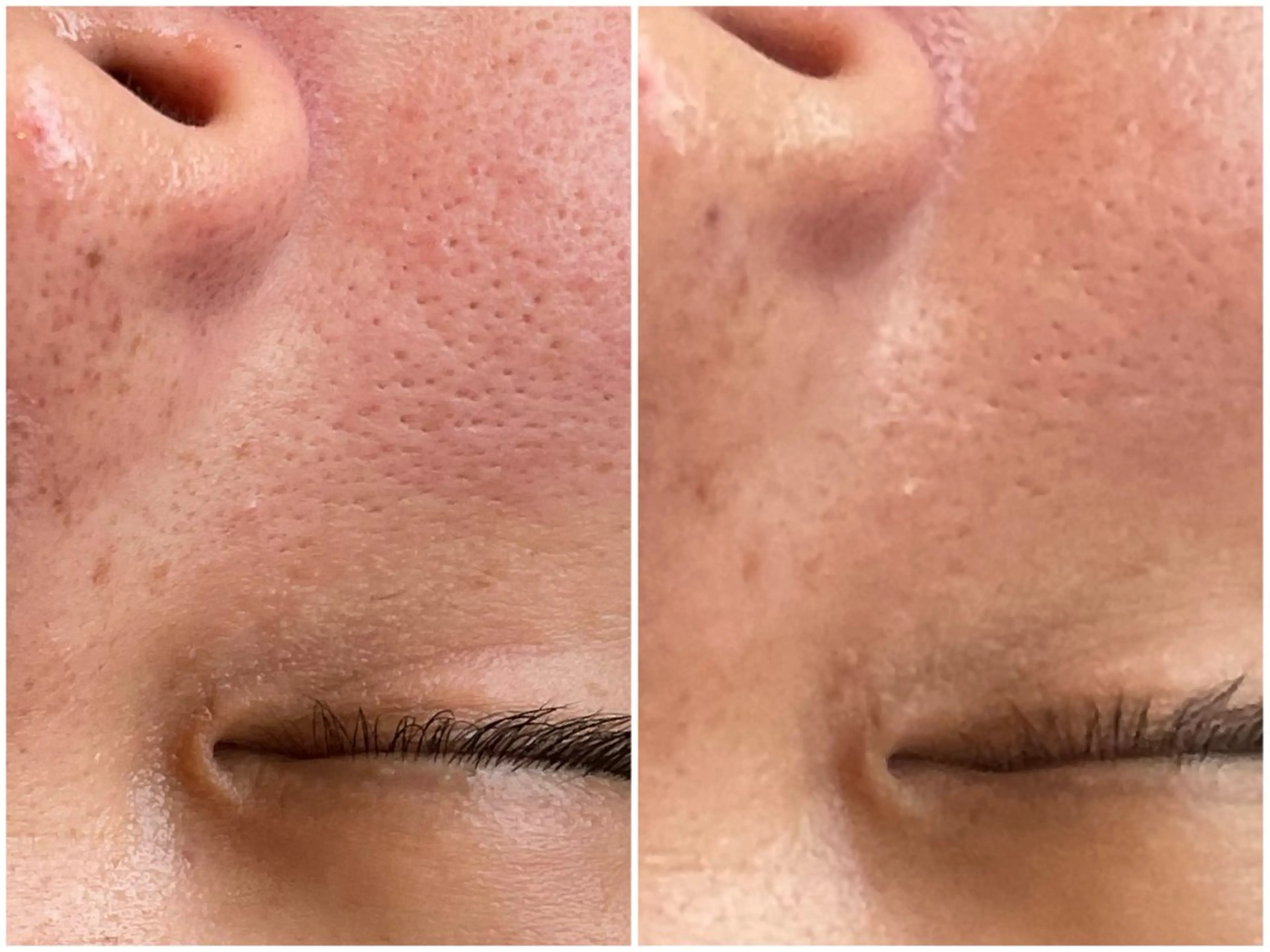 エステ プライベートサロン VIALLのエステ・リラクイメージ