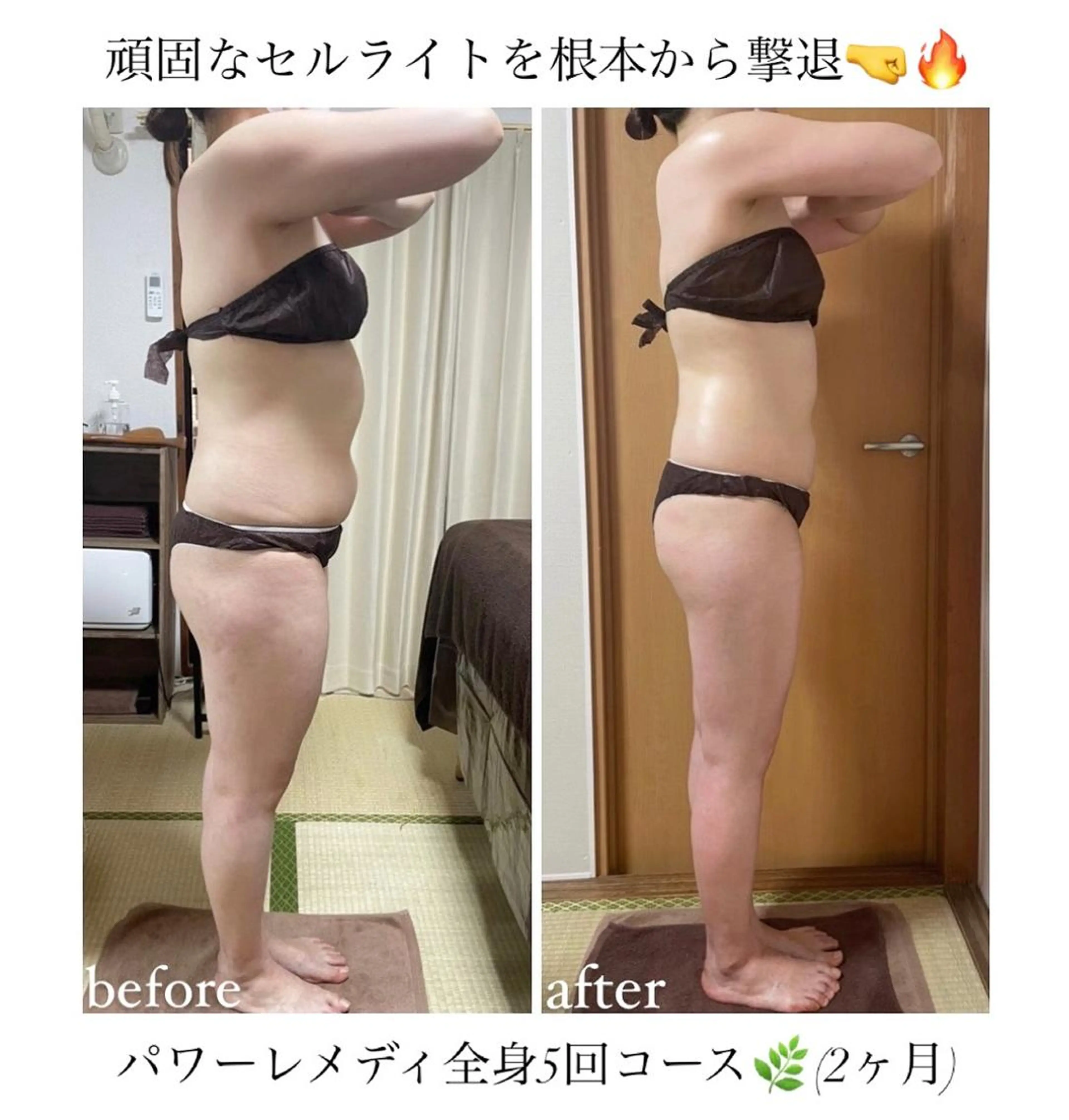 《本気痩せ×疲労改善 》  BILOOPのエステ・リラクイメージ