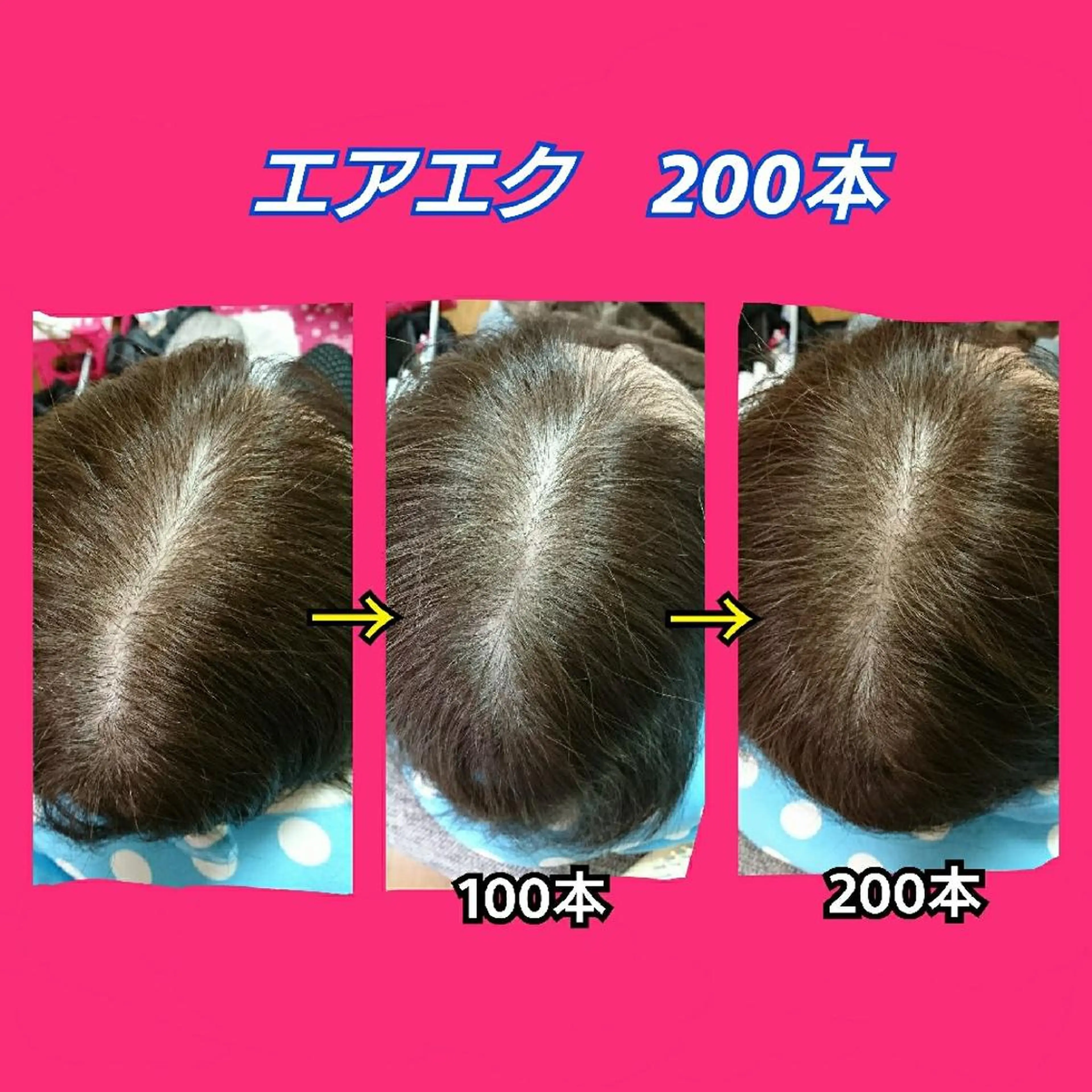 ミディアム ヘアアレンジ エクステ nail yukkoのネイルデザイン