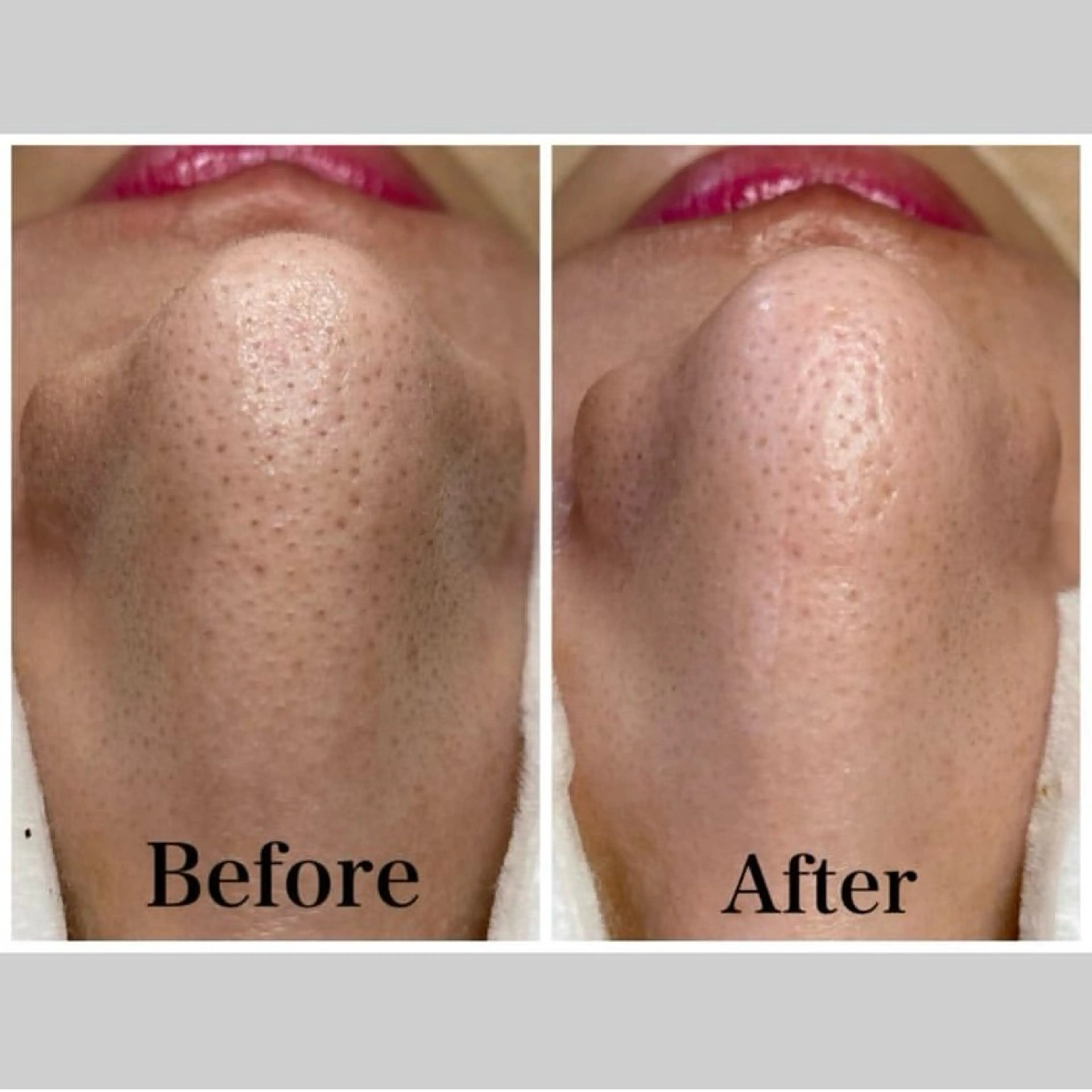 エステ リラク 韓国肌管理 【毛穴専科】のエステ・リラクイメージ