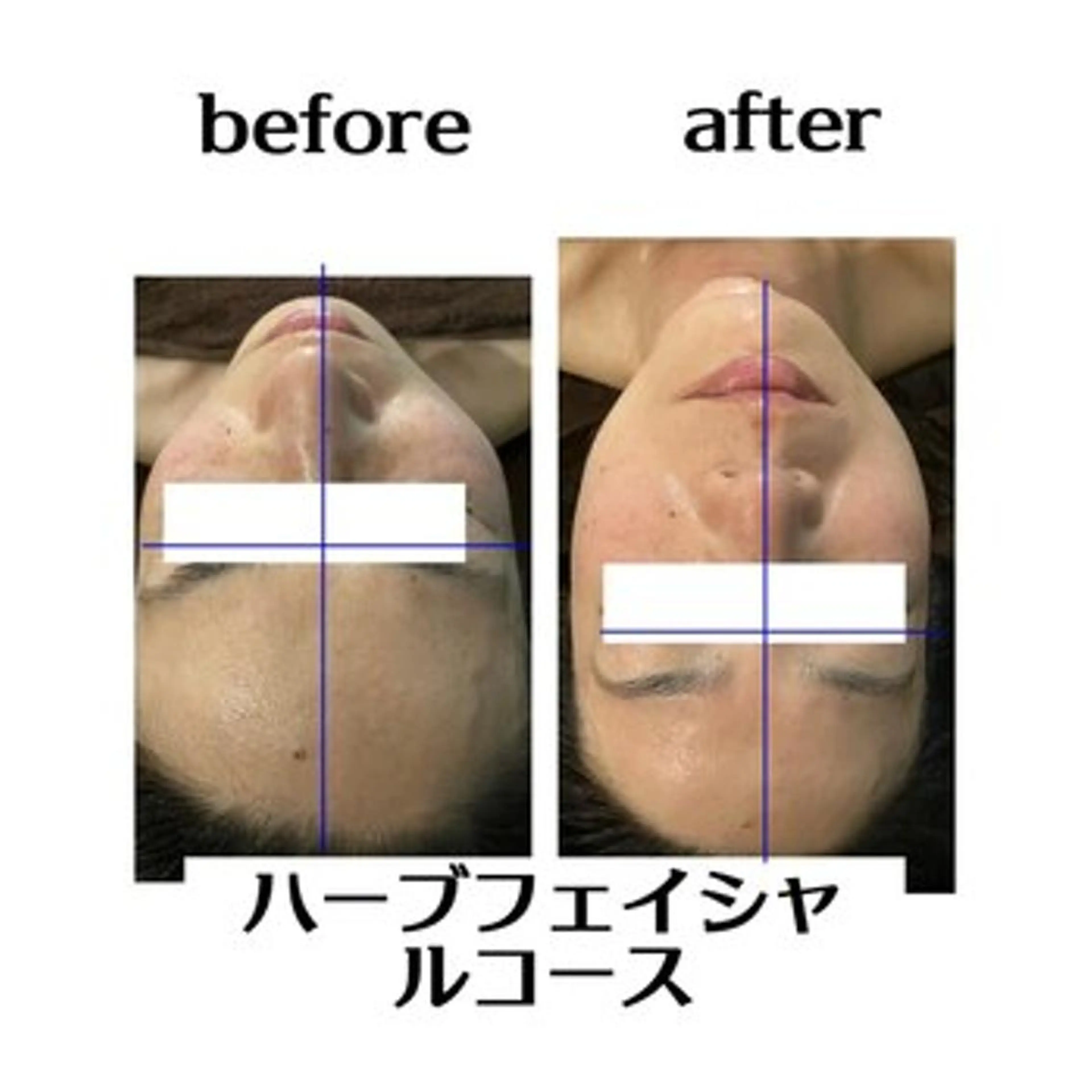 エステ Dione湘南藤沢店 ×LUANA　齋藤のエステ・リラクイメージ