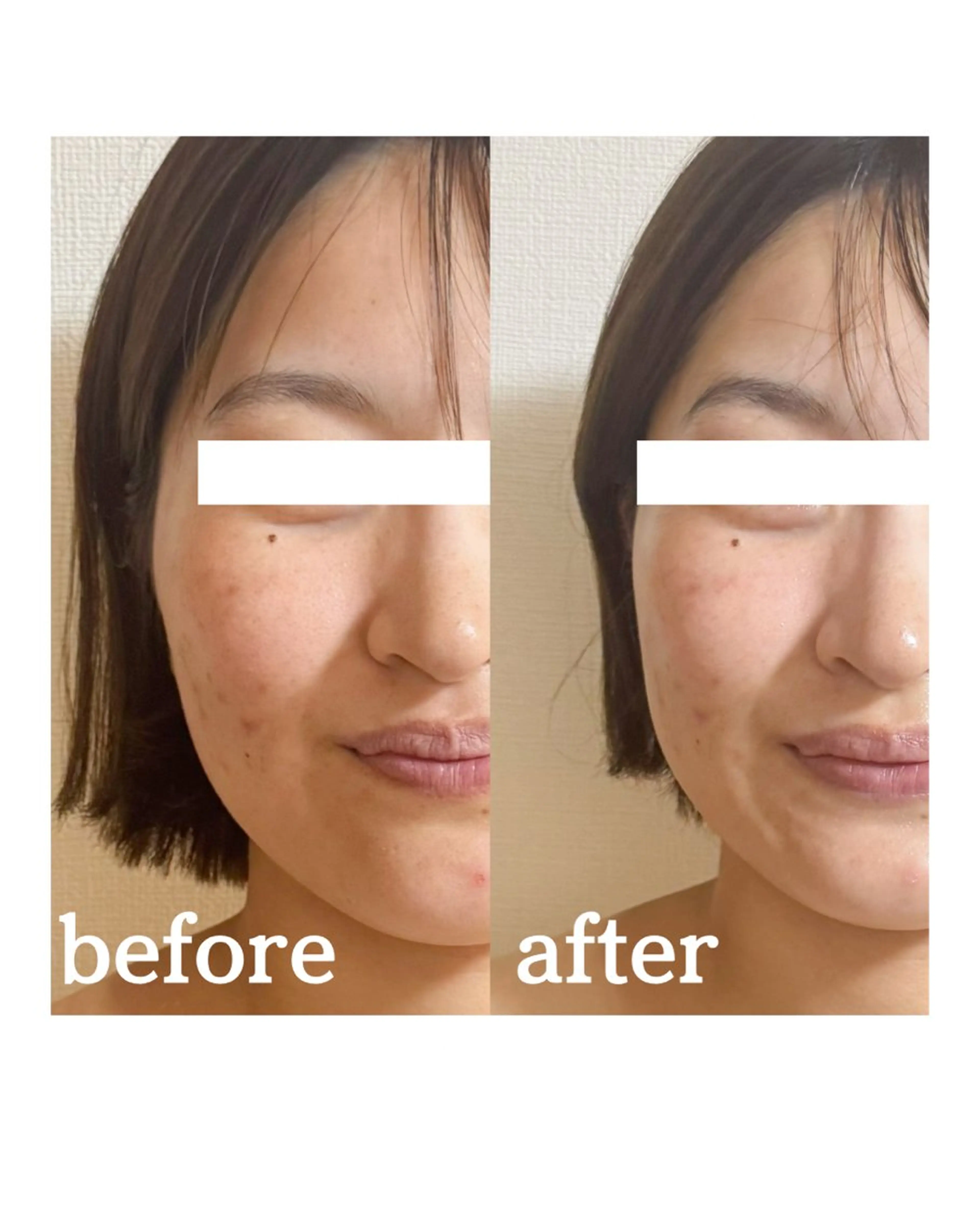 Mignon Luluのエステ・リラクイメージ