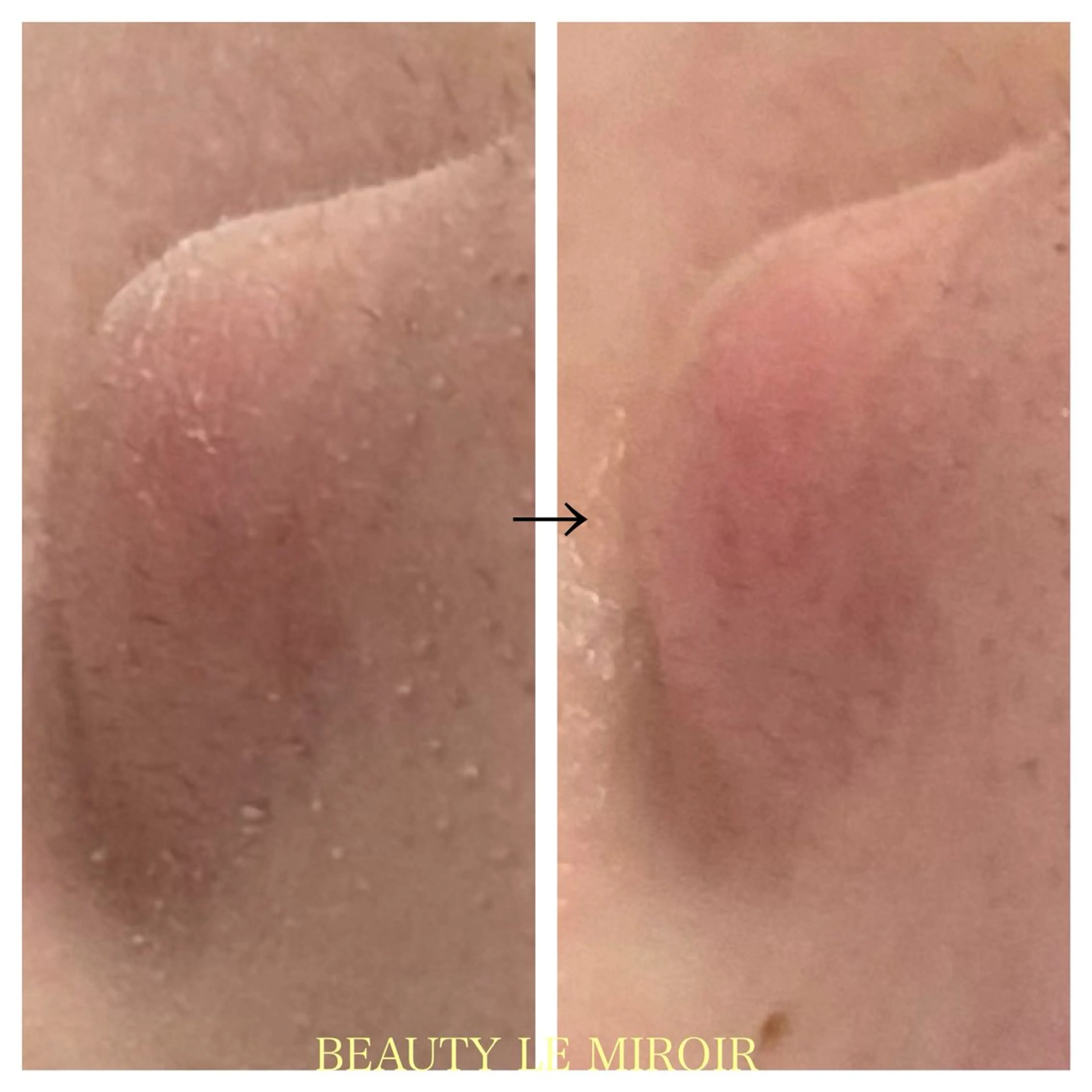 エステ ビューティー ミロワールのエステ・リラクイメージ