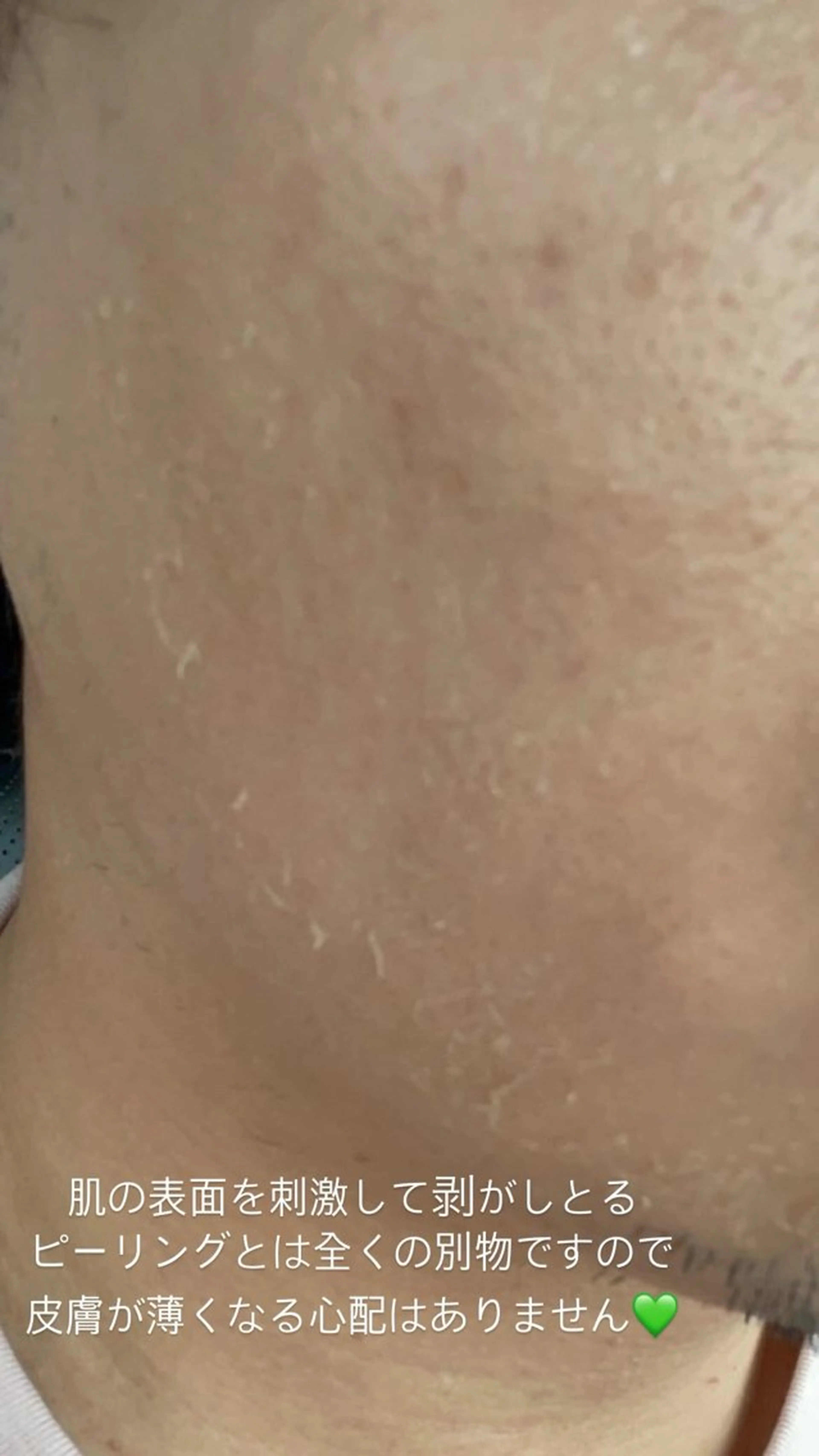 エステ brilliance所属・老化肌トラブル肌専門 Brillianceのエステ・リラクイメージ