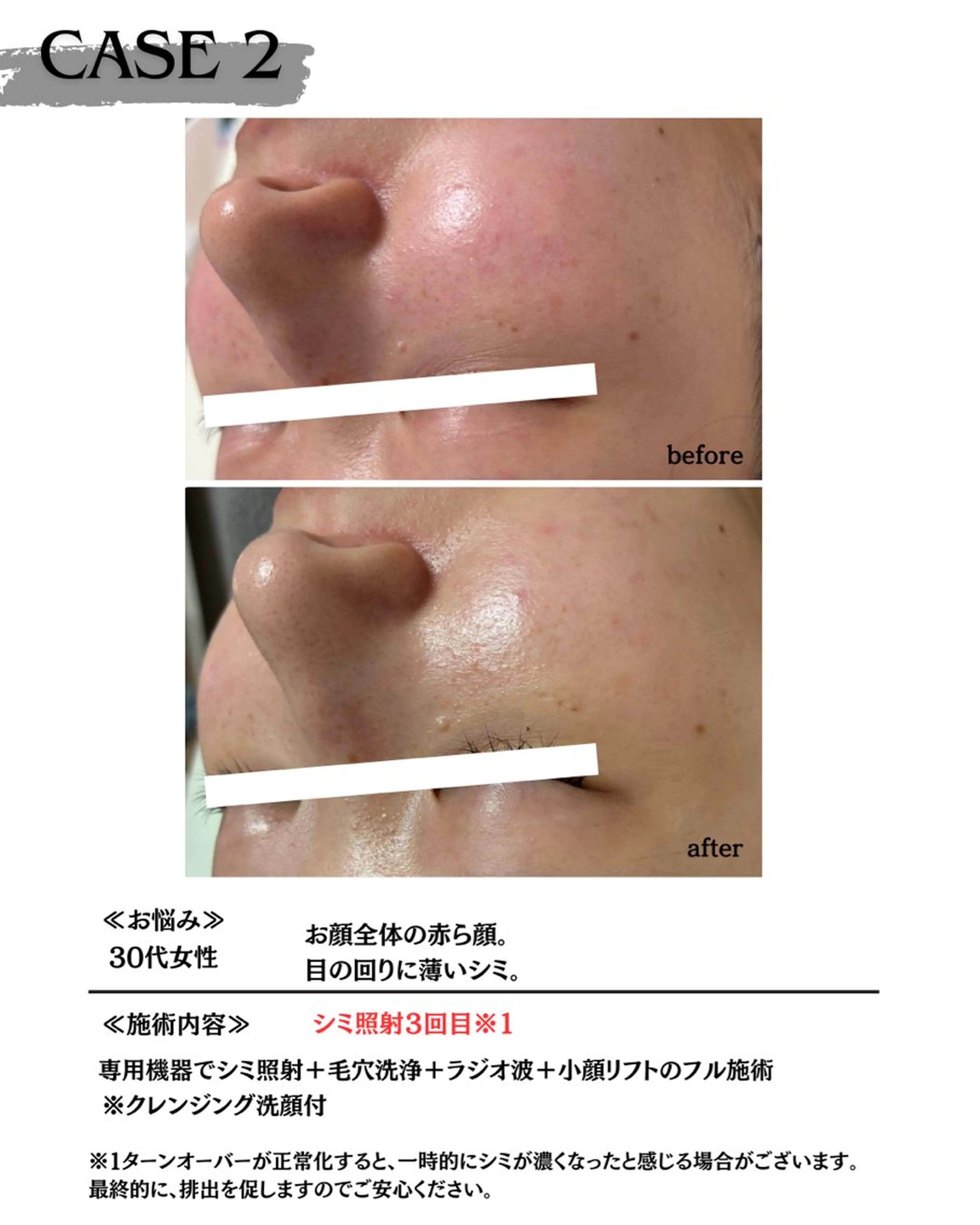 【医療提携サロン】 【シミケア専門】のエステ・リラクイメージ