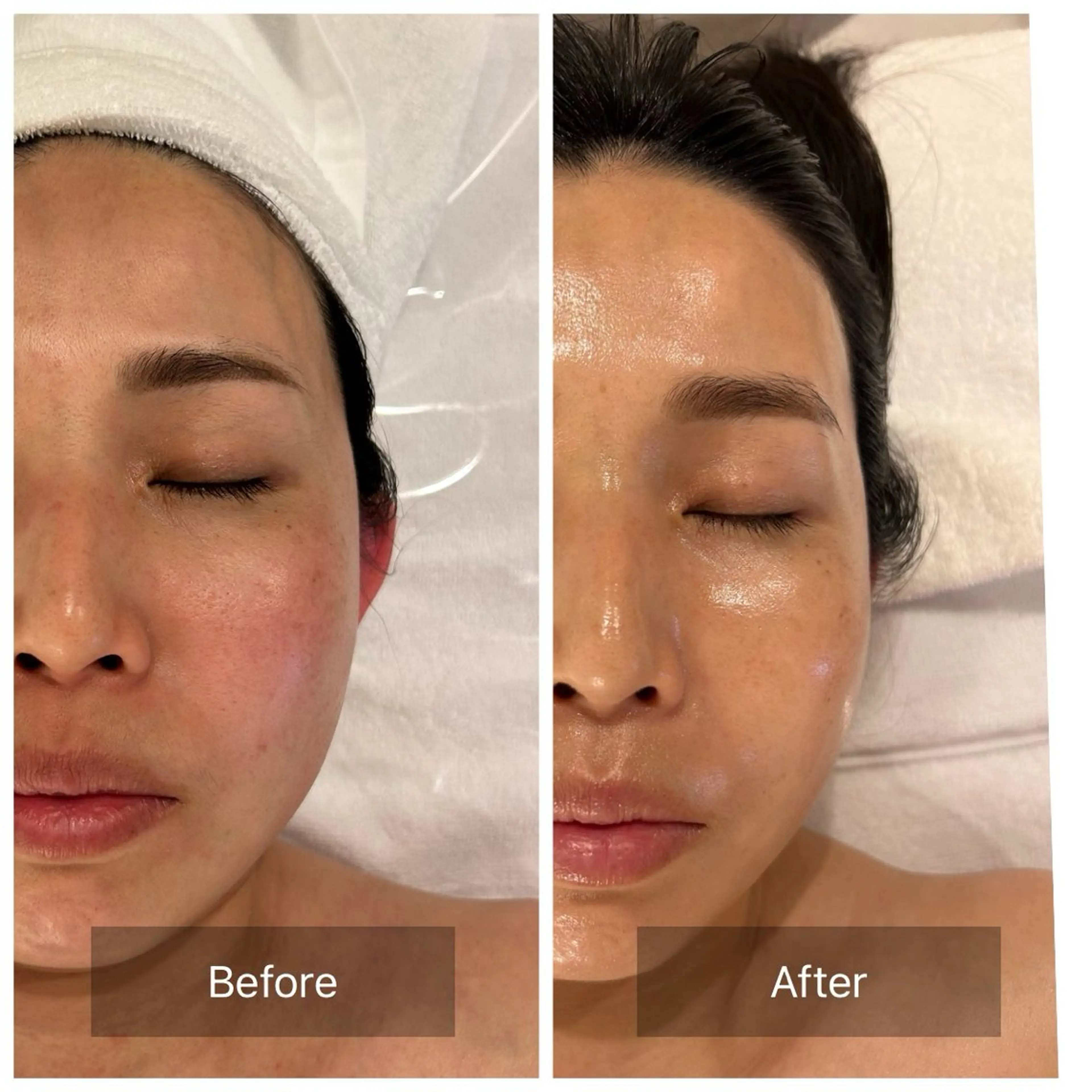 エステ mine.mi マインエムのエステ・リラクイメージ