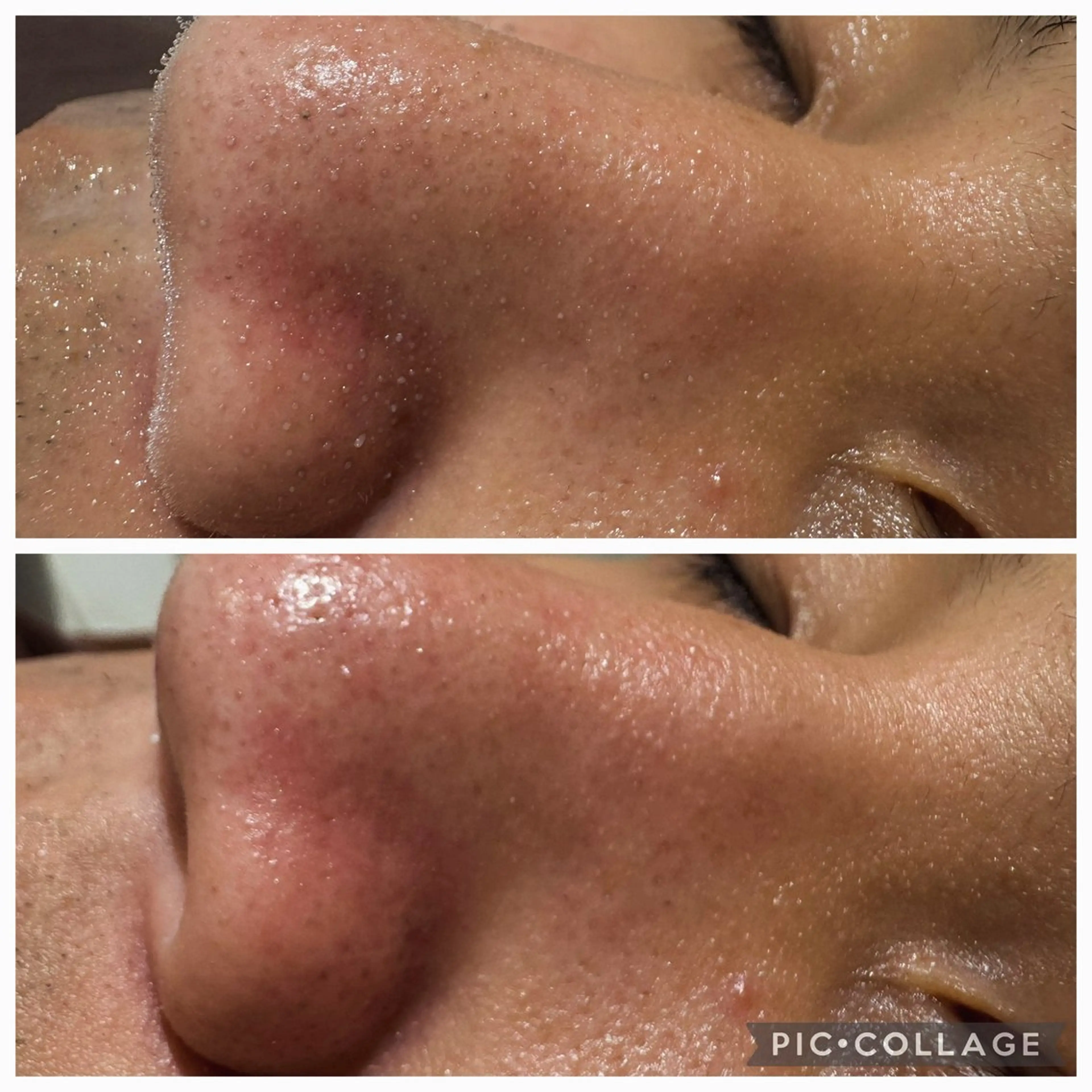 ニキビケア専門サロン Unityのエステ・リラクイメージ