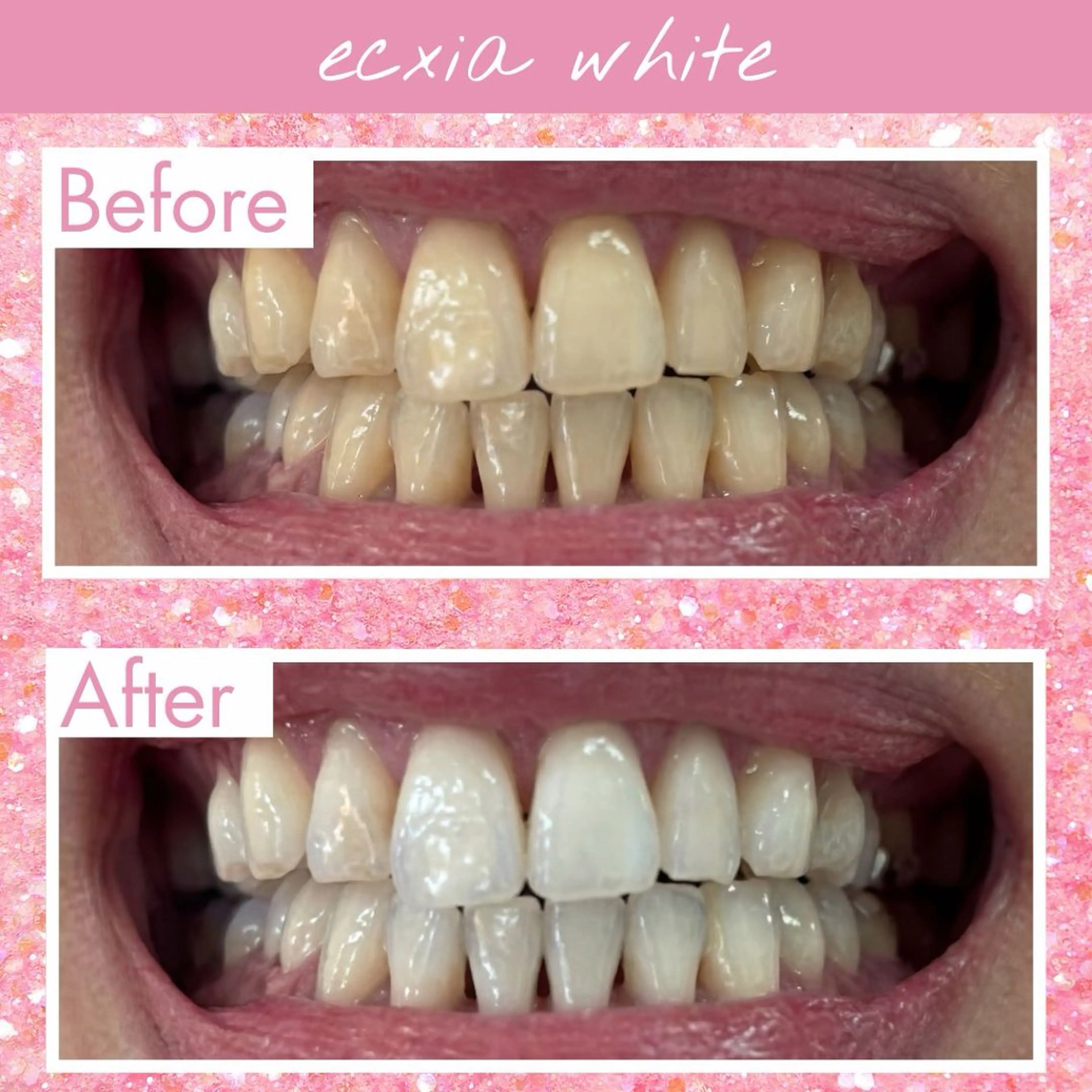 セルフホワイトニング エクシア泉中央店のその他イメージ