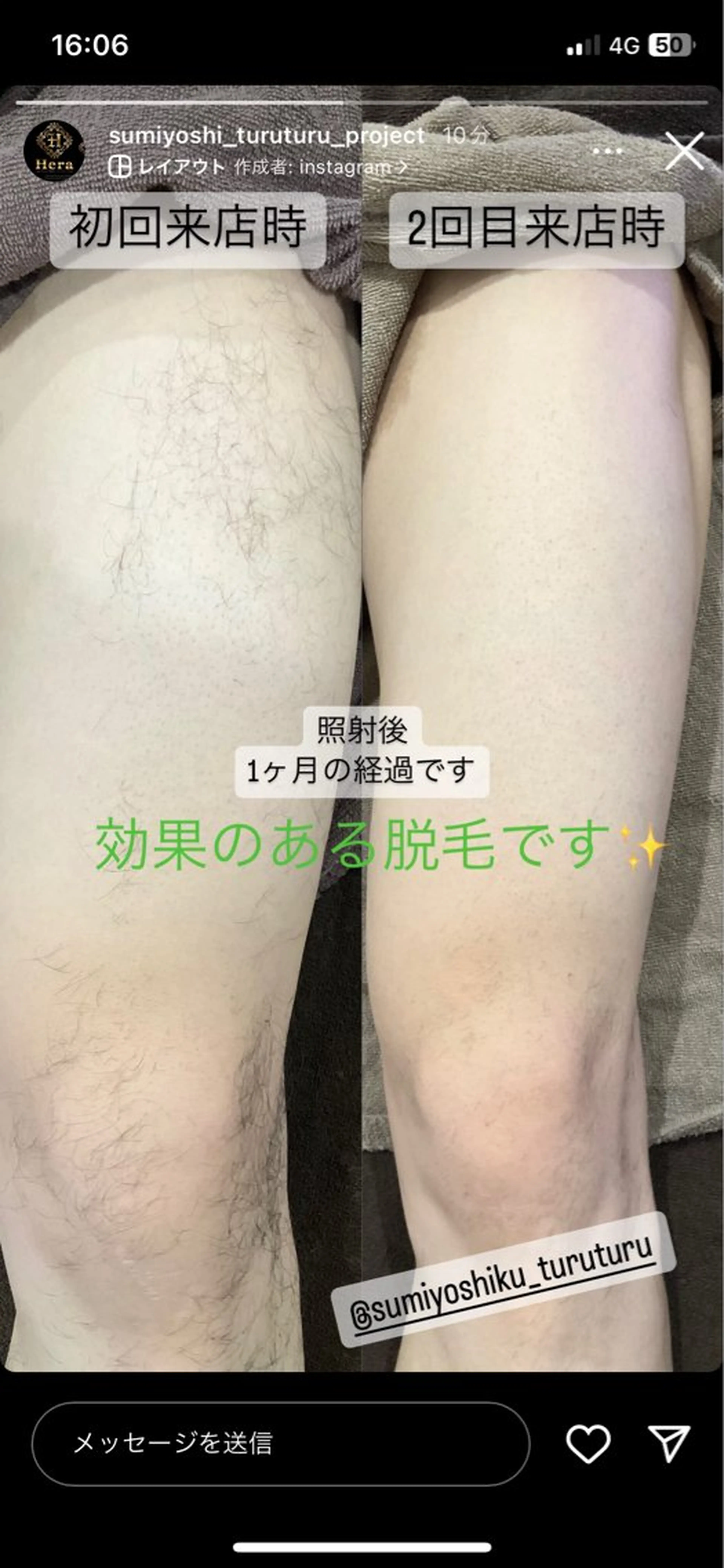 脱毛 パーソナル脱毛 GROOMのエステ・リラクイメージ