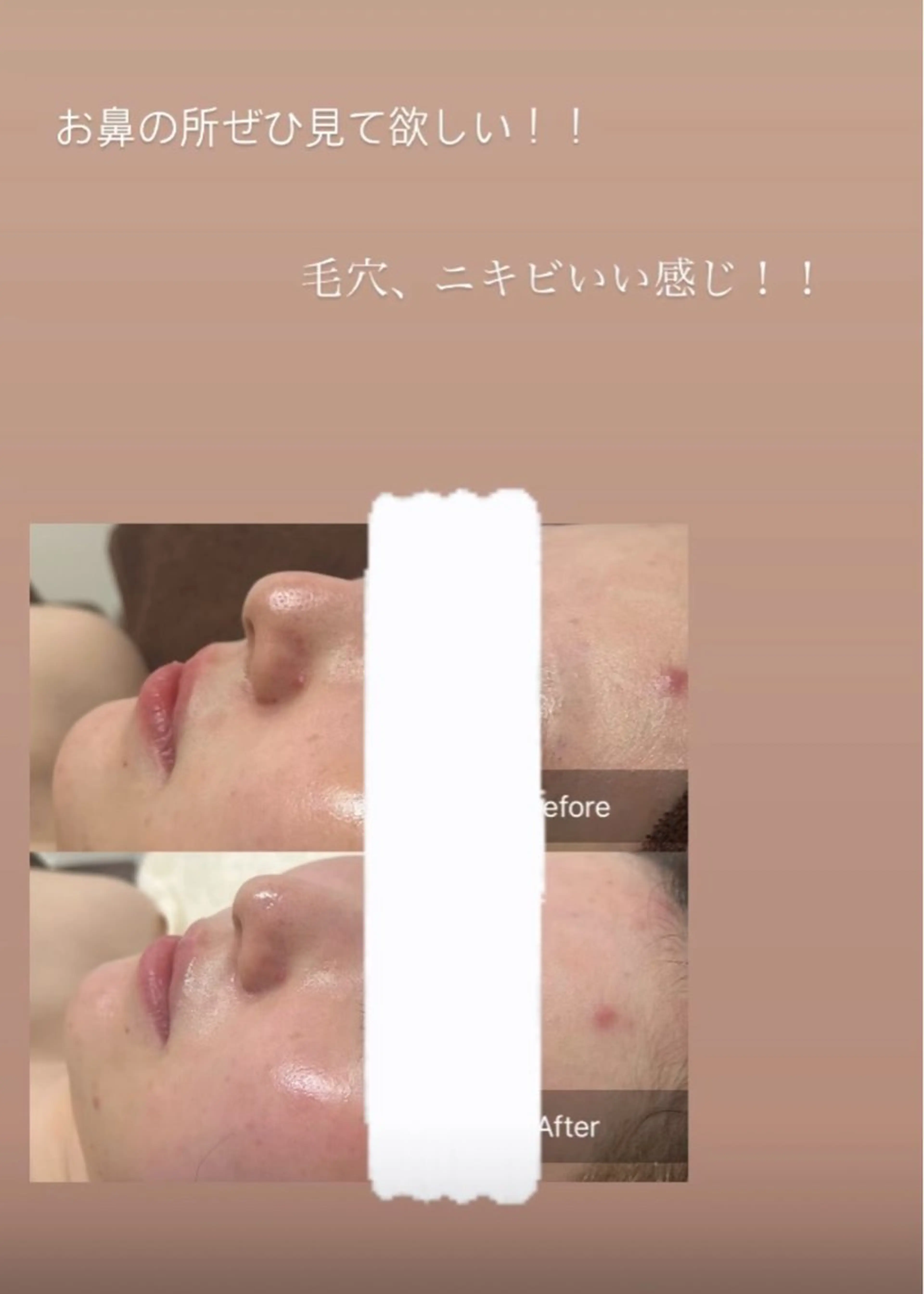 天使の艶肌　REVIハーブピーリング＆ヘッドスパ 武蔵小杉店所属・天使の 艶肌のエステ・リラクイメージ