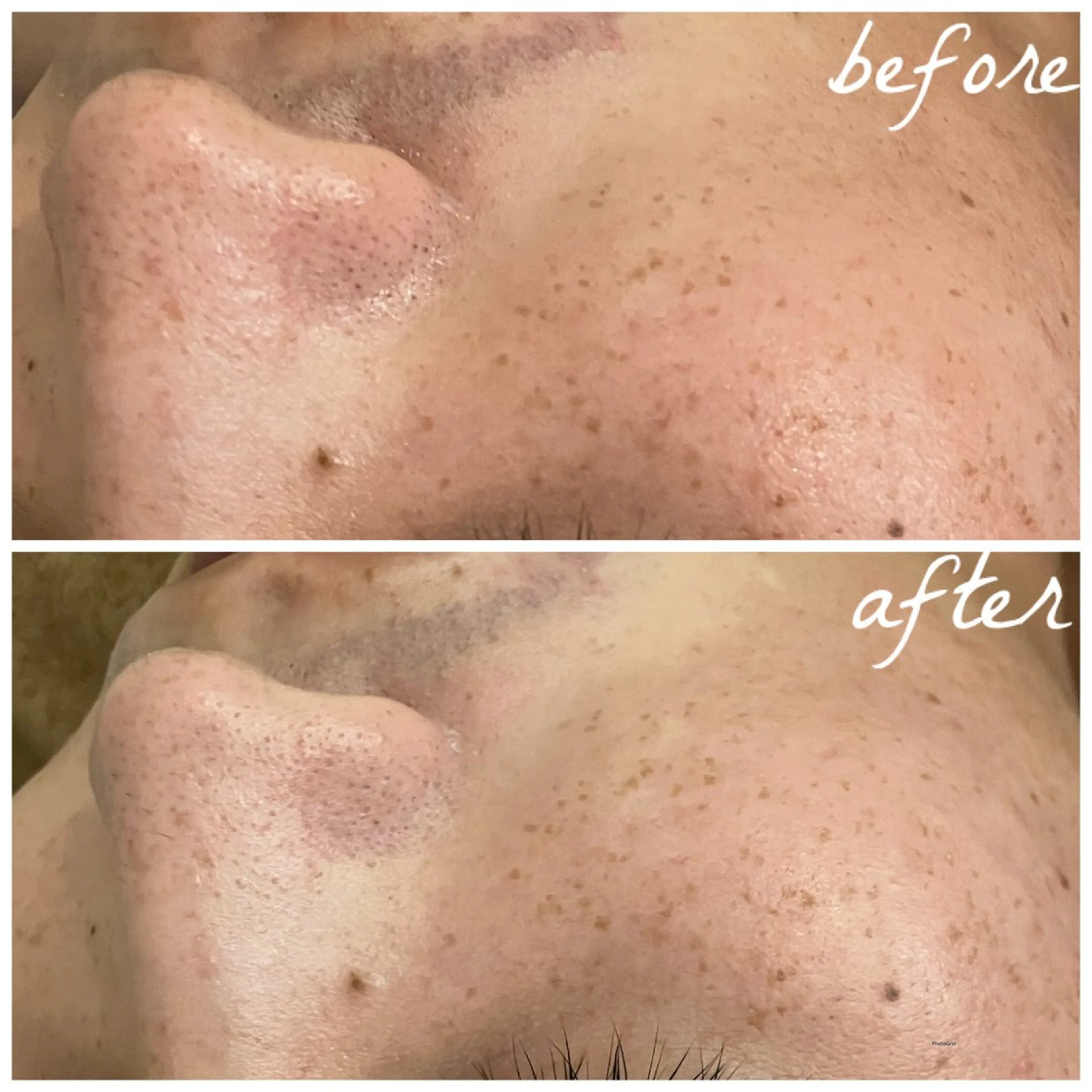 メンズ メナード岐阜市茜部 杉浦のエステ・リラクイメージ